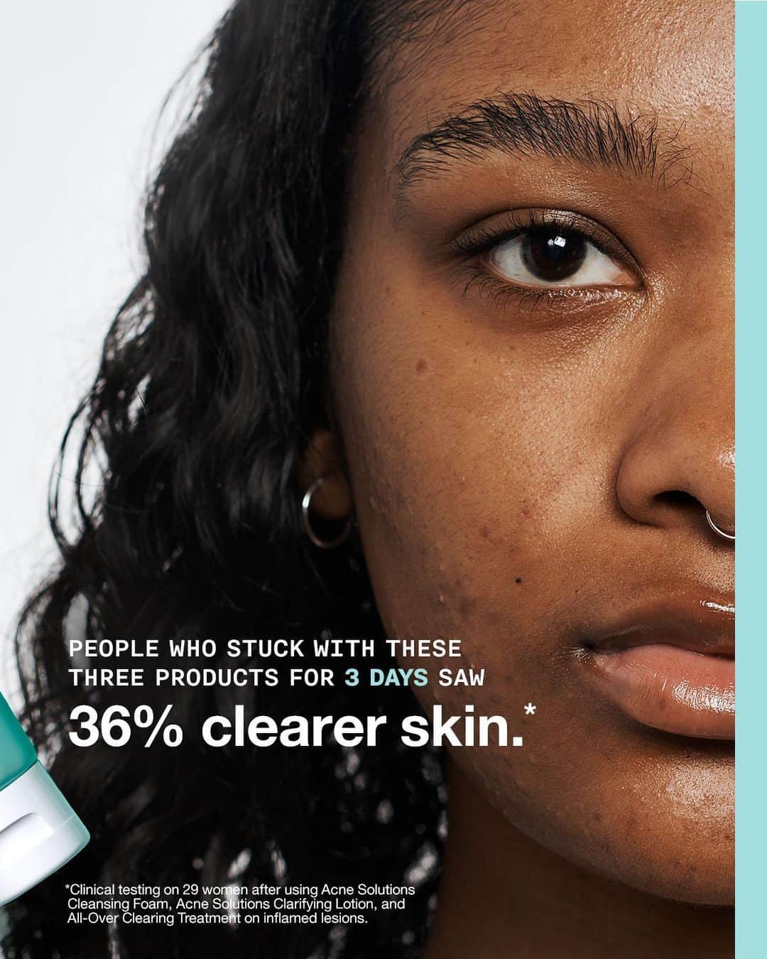 クリニークさんのインスタグラム写真 - (クリニークInstagram)「Skin School: Acne Management 101  #skinschool #acne #acneskincare #acneawarenessmonth #dermtested」6月26日 0時07分 - clinique