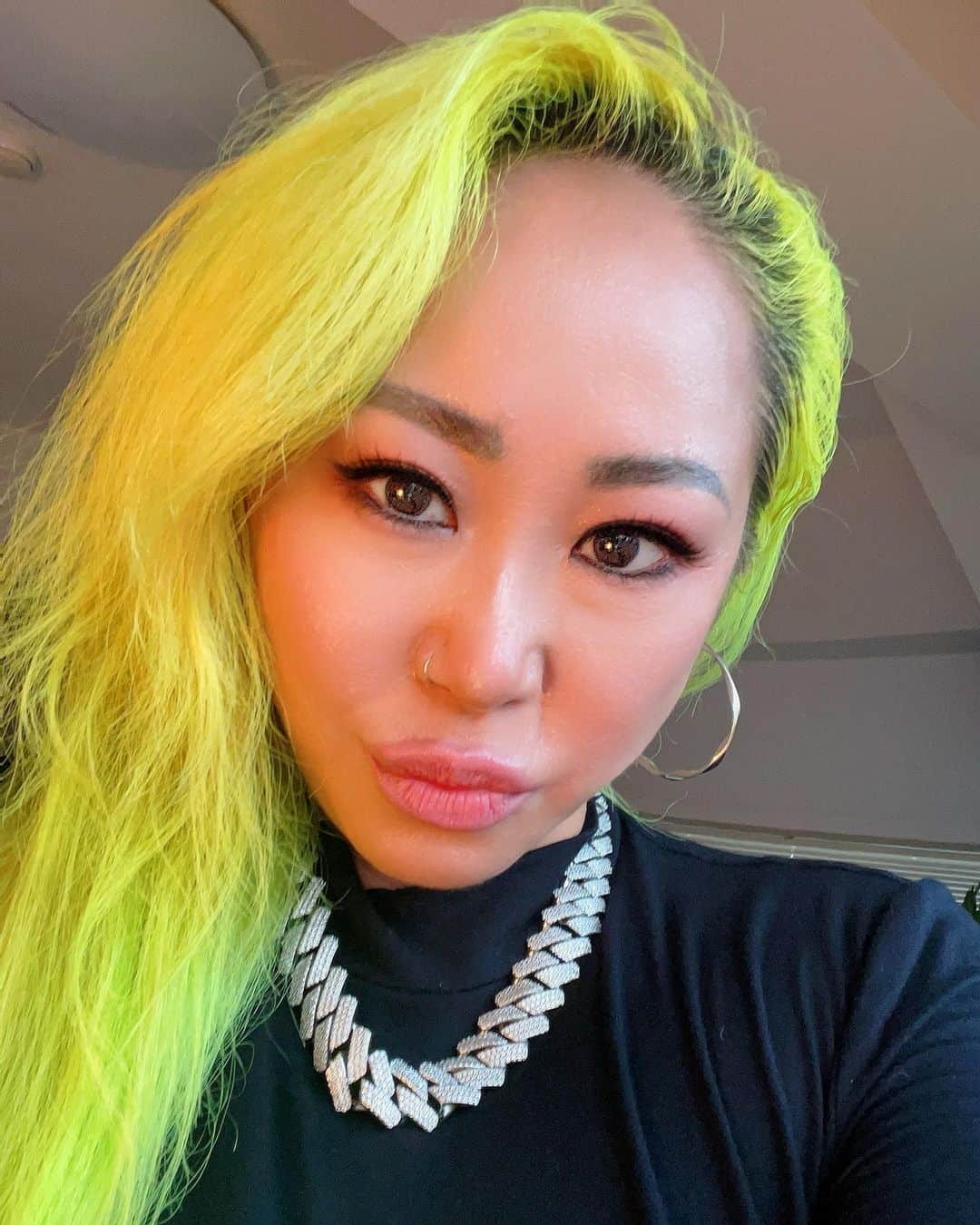 ルナのインスタグラム：「目ヂカラ復活🤝🏼 どうかな？？？ ダウンタイムなど深い話はYouTubeでゆっくり語ります!!! #埋没二重」