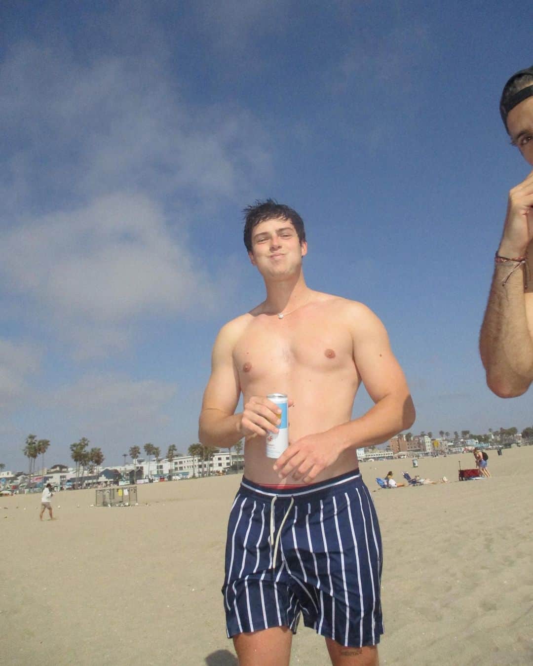 のインスタグラム：「The best time to wear some stripe shorts.. is allll the timeeee」
