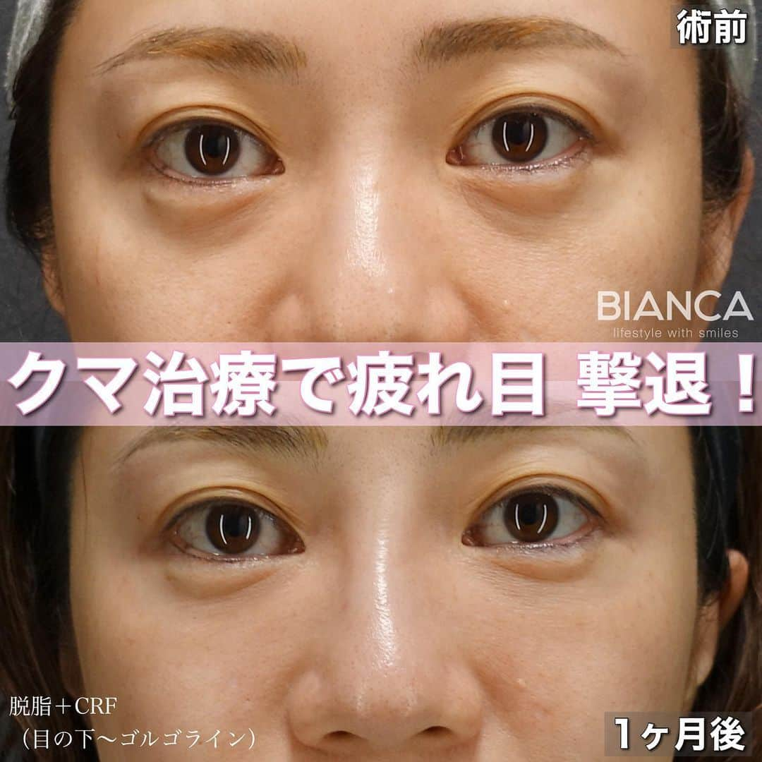 辻沢由有（BIANCA CLNIC 表参道院 院長）のインスタグラム