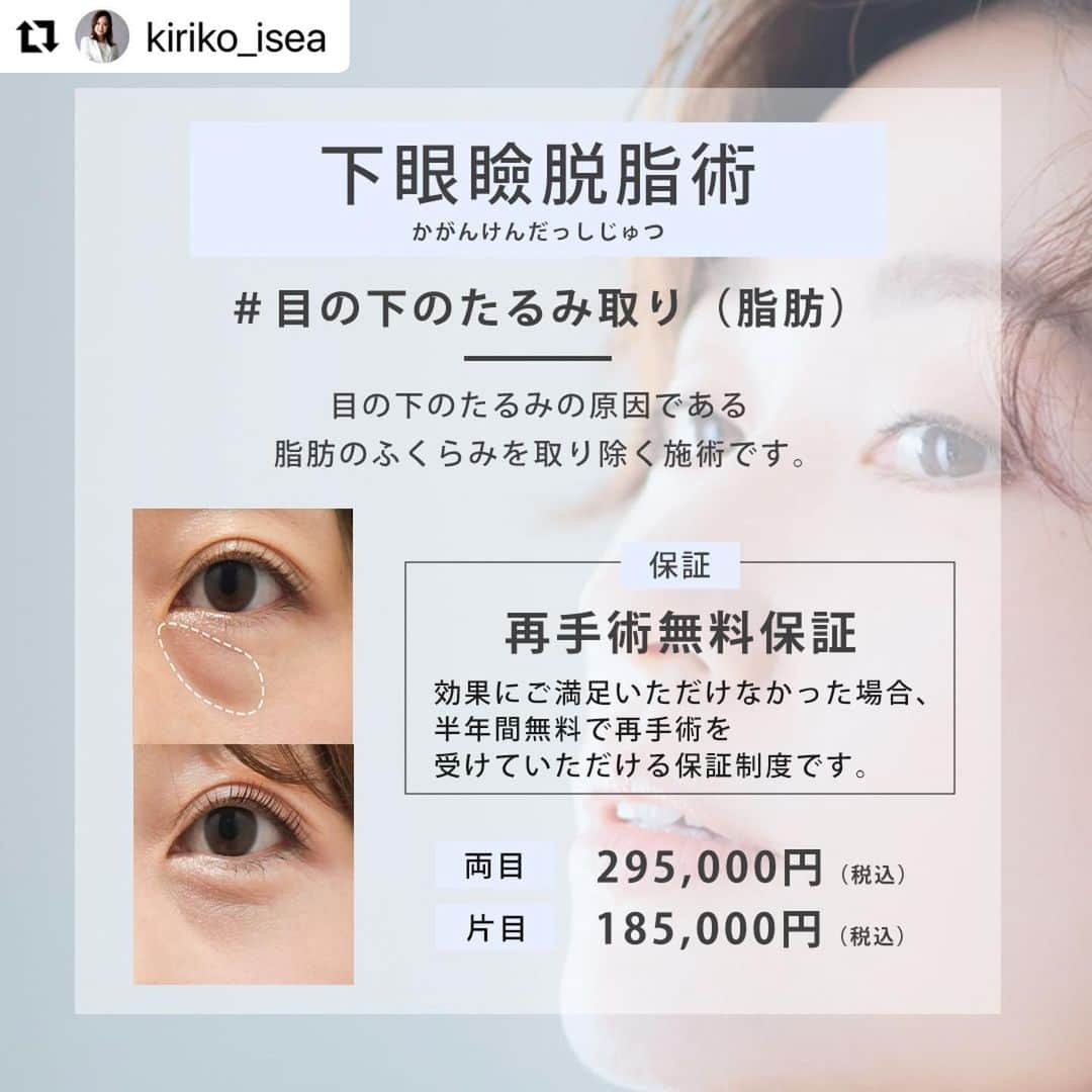 東京イセアクリニックさんのインスタグラム写真 - (東京イセアクリニックInstagram)「▶︎▷▶︎ #目の下のたるみ取り（脂肪） #下眼瞼脱脂術  ▼執刀医 Dr. 大山希里子　@kiriko_isea   ▼詳細  Before・・・術前 After ・・・1か月後  \\イセアの考え// 脂肪注入を行わず美しく仕上げること  -脂肪注入が不必要だと考える3つの理由- ①費用が余計にかかってしまう 脂肪注入の費用がプラスされ患者様の金銭的な負担が増えてしまいます。  ➁無駄なダウンタイムがかかってしまう 注入する脂肪を採取する太ももやお尻などに余計なダウンタイムを生じてしまいます。  ➂感染のリスクなどの可能性が上がってしまう 定着しなかった脂肪が壊死し、しこりになってしまいます。また感染症のリスクも増えてしまいます。  【施術の詳細】 🕐手術時間 ・・・約1時間 👁ダウンタイム・・・約1週間 📆完成まで ・・・約3か月 🏥術後の通院　・・・2回（1ヶ月検診、3ヶ月検診）  【下眼瞼脱脂術とは？】 目の結膜部分（アッカンベーをしたときに出る赤い粘膜部分）から、目の下の膨らみの原因となる脂肪を取り除く施術です。  【こんな方におすすめ！】 ✔️目の下のたるみを改善したい方 ✔️目の下の膨らみが気になる方 ✔️目の下のクマが気になる方  【保証について】 ・再手術無料保証 効果に満足いただけなかった場合、6ヶ月間無料で再手術を受けていただける保証制度です。  【リスクについて】 凹み、くぼみ、感染、左右差が生じる、小ジワや皮膚のたるみが目立つ可能性  ---------------------------  ▫️術名 下眼瞼脱脂術 ー目の下のたるみ取り（脂肪）  ▪️料金 両目　295,000円(税込) (麻酔費・痛み止め費・再施術費込み)  ⏩目の下のたるみ治療だけの 症例写真やお役立ちコンテンツを毎日更新！ 『　@menoshita_isea　』 ご質問がある方はお気軽にDMして下さい🙋‍♂️  #目の下のたるみ #目の下のクマ #目の下のたるみ取り #目の下のたるみ治療 #目の下クマ治療 #目の下のクマたるみ治療 #下眼瞼脱脂術 #イセアの目の下のたるみ治療 #経結膜法 #下眼瞼除皺術 #下眼瞼脱脂＋除皺術 #ハムラ法 #美容クリニック #美容整形 #目の下 #目の下の改善 #目の下のクマ改善 #目の下のふくらみ取り #目の下のふくらみ #目の下の脂肪 #目の下整形 #東京イセアクリニック #イセア #ISEACLINIC #吉種克之 #鈴木知佳 #大山希里子」6月5日 15時25分 - iseaclinic