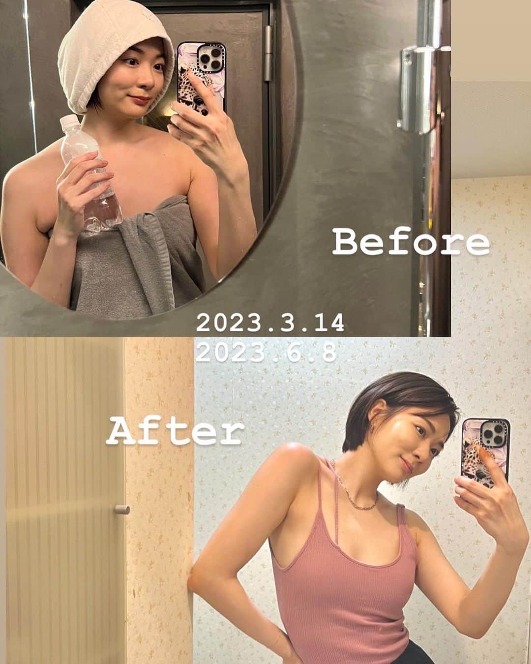 井咲アキのインスタグラム：「💊✨  話題の若返りサプリNMNに、  "レスベラトロール" "アスタキサンチン" "ビタミンA"  が配合されたNMN DIOSA♡  私は服用してこんな体感があったよ☺️✨  ⌘直近のピーク体重から6kg減  (服用してから4〜5kg減) ⌘疲れづらくなった ⌘怠さがなくなった ⌘寝つきと寝起きがよくなった ⌘肌のツヤやハリが増し、ニキビもできづらくなった  元々、睡眠障害かな？？と思っていたくらい 睡眠の質が悪かったのが改善されたのが嬉しい🥺🌸  体力もなくて凄い疲れやすかったし、 なかなか痩せなくて太る一方だったのも 一気に痩せてこの通り！！😭✨(1枚目写真)  ⚠︎体感には個人差があります。  気になる方は気軽にDMしてください☺️🩷 ・ ・ ・ #NMN#NMNサプリ#NMNDIOSA#QUALIA #若返り#若返りサプリ#美容#健康#ダイエット#PR #nmnsupplement#beauty#healthylifestyle」