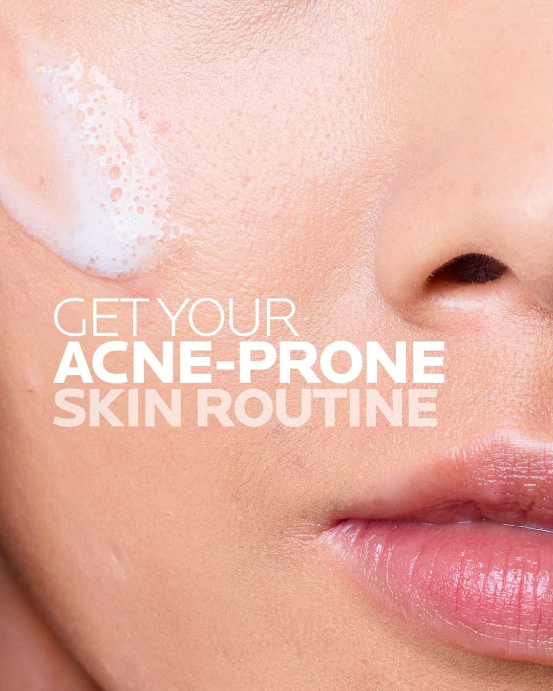 La Roche-Posayのインスタグラム：「Get your all-in imperfection skin routine! Reducing skin imperfections is not a one product job! Some triggers need to be addressed individually. Yes, we make it very personal! A complete routine is often what works best, combining different solutions to address each factor. Here’s an example of a complete routine:   ⚖️ Effaclar Foaming Gel to maintain your skin pH 💫  Effaclar Duo+ to correct your imperfections 🛡️ Anthelios UV Mune 400 oil control fluid to protect against harmful UV rays   You have a La Roche Posay routine that works for your oily skin? Share it with the community! ✏️  All languages spoken here! Feel free to talk to us at anytime. #larocheposay #effaclar #anthelios #acneproneskin #sensitiveskin #sunprotection Global official page from La Roche-Posay, France.」