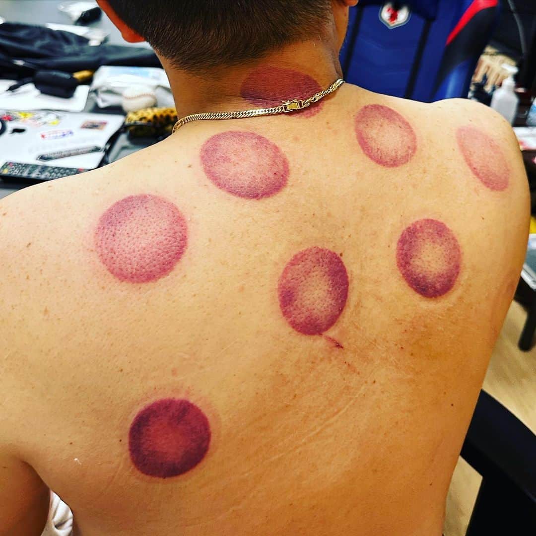 マッコイ斉藤さんのインスタグラム写真 - (マッコイ斉藤Instagram)「血行が悪いらしいです。」6月11日 18時28分 - maccoi_saito