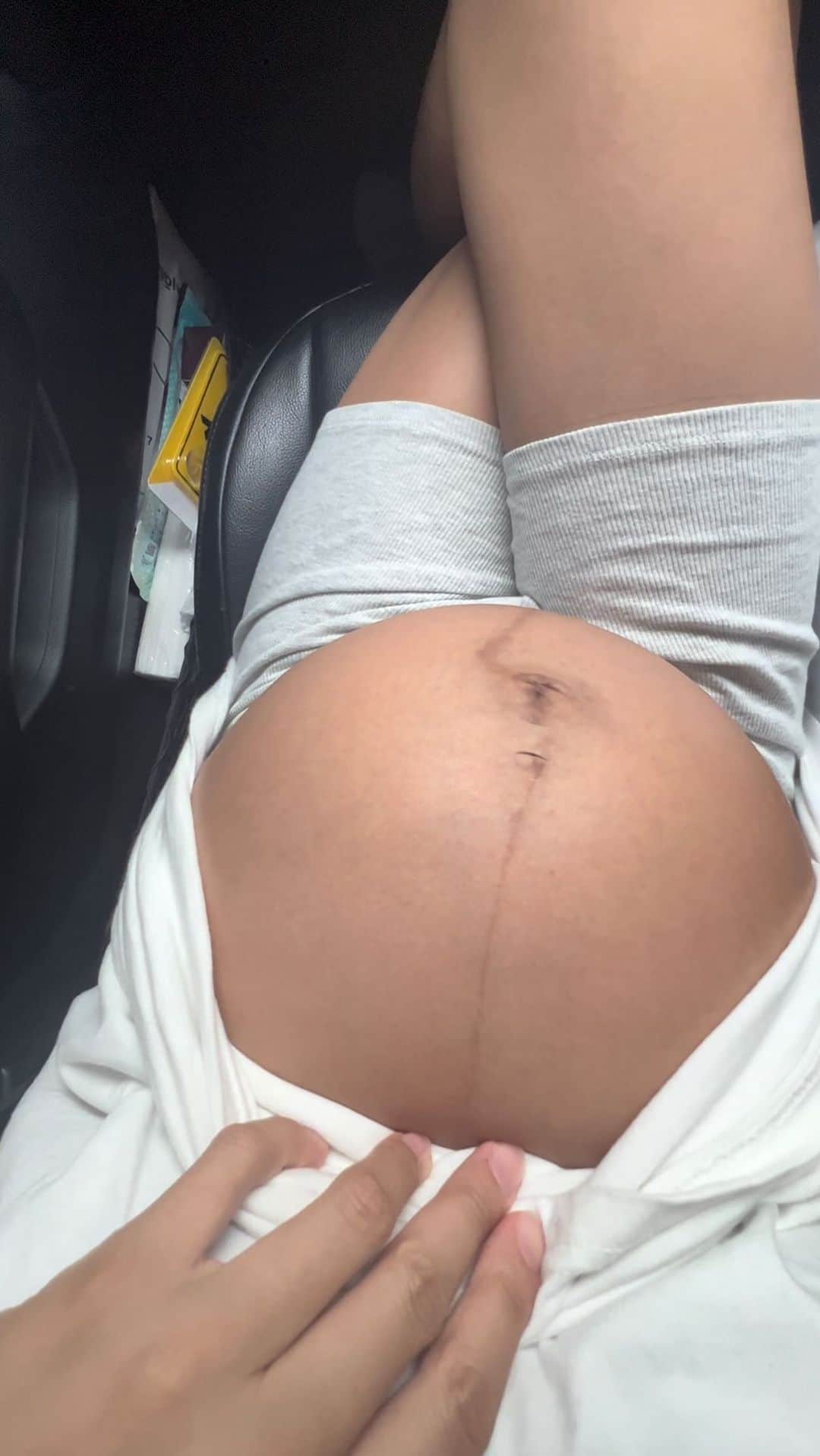 古賀あかねのインスタグラム：「毎日赤ちゃんパワフルすぎてお腹破れそう👶🏽  #34weeks #34w」