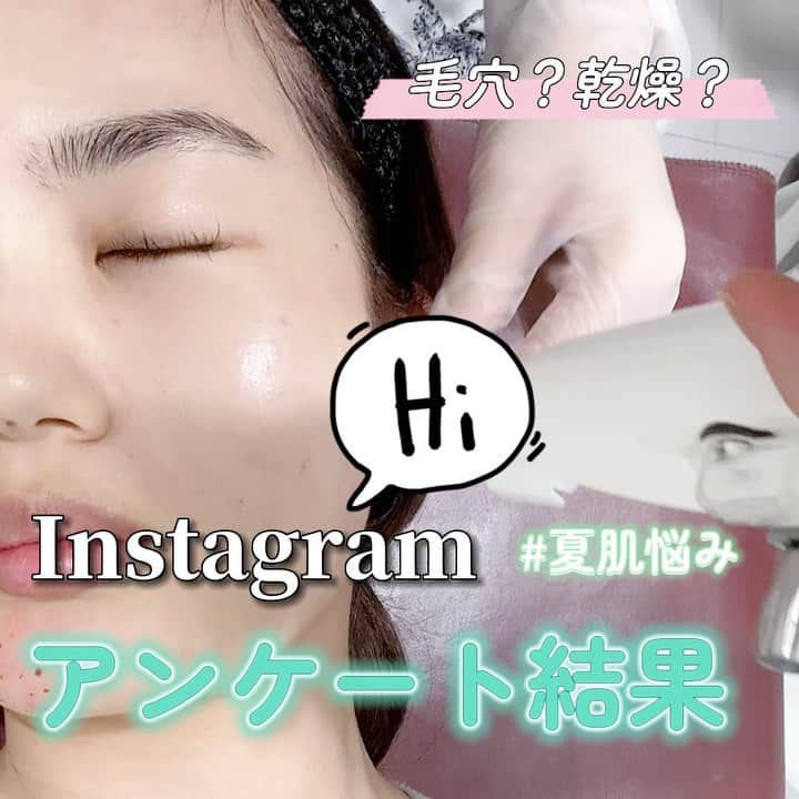 オラクル美容皮膚科東京新宿院のインスタグラム：「⁡ 안녕하세요～＾＾ ⁡ 先日ストーリーで行ったアンケート ご回答くださった皆様 カムサハムニダ♥ ⁡ ⁡ 結果は、、、 ⁡ ⁡ 「肌がベタつくㅜㅜドロドロ毛穴」が圧勝🥵 やはり、蒸し暑い季節は お肌がべたつきやすい方が多いですねㅜㅜ ⁡ *⌒*⌒*⌒*⌒*⌒* ⁡ ①、②それぞれにおすすめの 施術は？ ⁡ ①夏の乾燥肌には →メソナJ or 水光注射 ⁡ 直後からもちもち感を実感しやすい"メソナJ"💎 ダウンタイムはあるけど"水光注射"ならではのハリ艶感も魅力があり人気の高い施術です✨ ⁡ ⁡ ⁡ ②ドロドロ毛穴には ハイドラフェイシャル×メソナJの組み合わせ メソナJはプラスのボトックス導入がおすすめ！ (保湿、毛穴引き締め、皮脂抑制効果) 6月は40％OFFイベント中🉐 ⁡ *⌒*⌒*⌒*⌒*⌒* ⁡ それぞれのお悩み別治療で 夏でも快適な潤サラ肌に😉 ⁡ ⁡ ⁡ 【料金】 夏の乾燥肌には ●メソナJ美白肌コース　28,600円 ●水光注射1回　17,600円〜 ⁡ ドロドロ毛穴には ●ハイドラフェイシャル　17,600円 ●メソナJプラス ボトックス導入 ［6月40％OFF！］23,100円　※通常38,500円 ※全て税込 ⁡ ⁡ ⁡ ⁡ #肌悩み #乾燥肌  #脂性肌 #毛穴 #毛穴ケア #インナードライ  #保湿 #肌荒れ  #肌荒れ改善  #メソナJ #水光注射 #ハリ #水光肌 #艶  #美白 #ボトックス #毛穴引き締め」