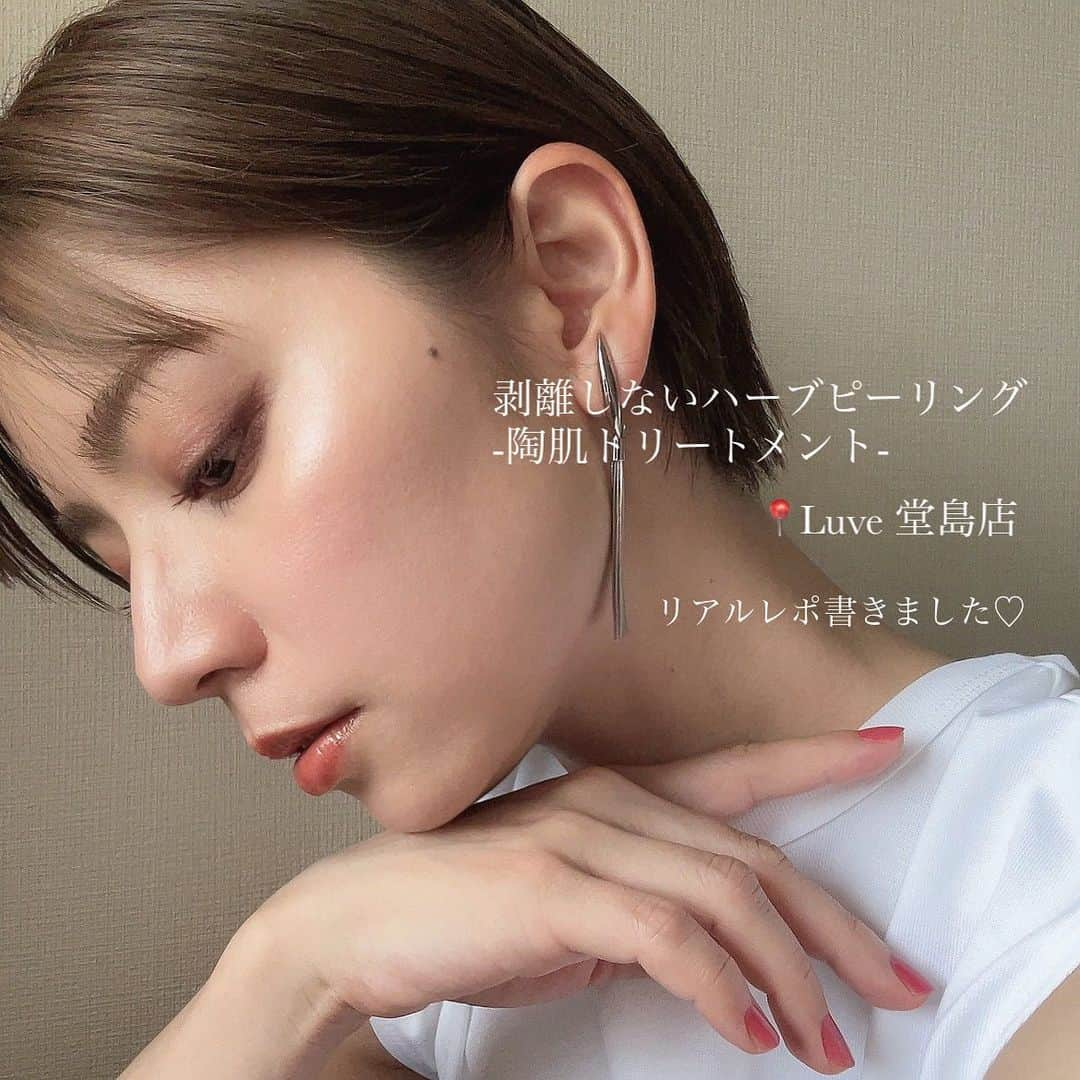 筒井愛実さんのインスタグラム写真 - (筒井愛実Instagram)「． \ 剥離しないハーブピーリング /  最近女優さんや美容家の方も注目している 〝陶肌トリートメント〟  わたしは皮膚が薄く、敏感で荒れやすい肌質。 産後は特に不安定でボコボコした大きな吹き出物・頬の赤みが治らず、困っていた時にLuveのハーブピーリングを知りました🌿 担当は @ayumi_luve さんです☻  1回目の時は人生最大くらいに肌荒れしていたけど、施術後に何をやってもダメだった頬の赤みが引いて肌がウルウル艶々になったことに感動し、そのあとも約1ヶ月に1回の頻度で通いました。  先週3回目を受けてきたのですが、写真をみてもらうと分かると思うのですが、もう別人みたいな肌でしょ？  2週間に1回受けるとより早く回復するらしいのですが、本当に月2回通ったら発光美肌になれると思う🥚✨  数ヶ月かけてやっと肌がキレイになってきたので、これからもガチで月1通おうと決めました✊ ※億万長者になれたら月2通います  同じような悩みを抱えている方がいたら、1度施術を受けてみてほしいくらい、心の底からとってもオススメします‼︎ ． #Luve #Luve堂島 #ハーブピーリング #剥離しないハーブピーリング #陶肌トリートメント」6月16日 8時05分 - manamin_158cm