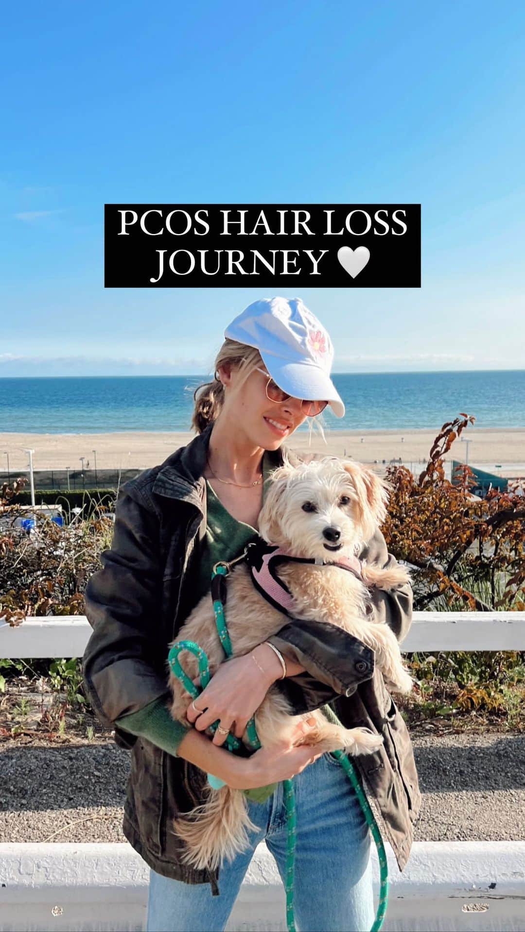 Elizabeth Turnerのインスタグラム：「For all of y'all who identified with my first reel about PCOS- I see you and we're in this together! Comment or message me if you've been struggling with hair loss and let me know what you've tried and what's working!!! Happy weekend! Love y'all!!! #pcos #pcosawareness #hairloss and thank god for @emilycablehair 🤍🤍」