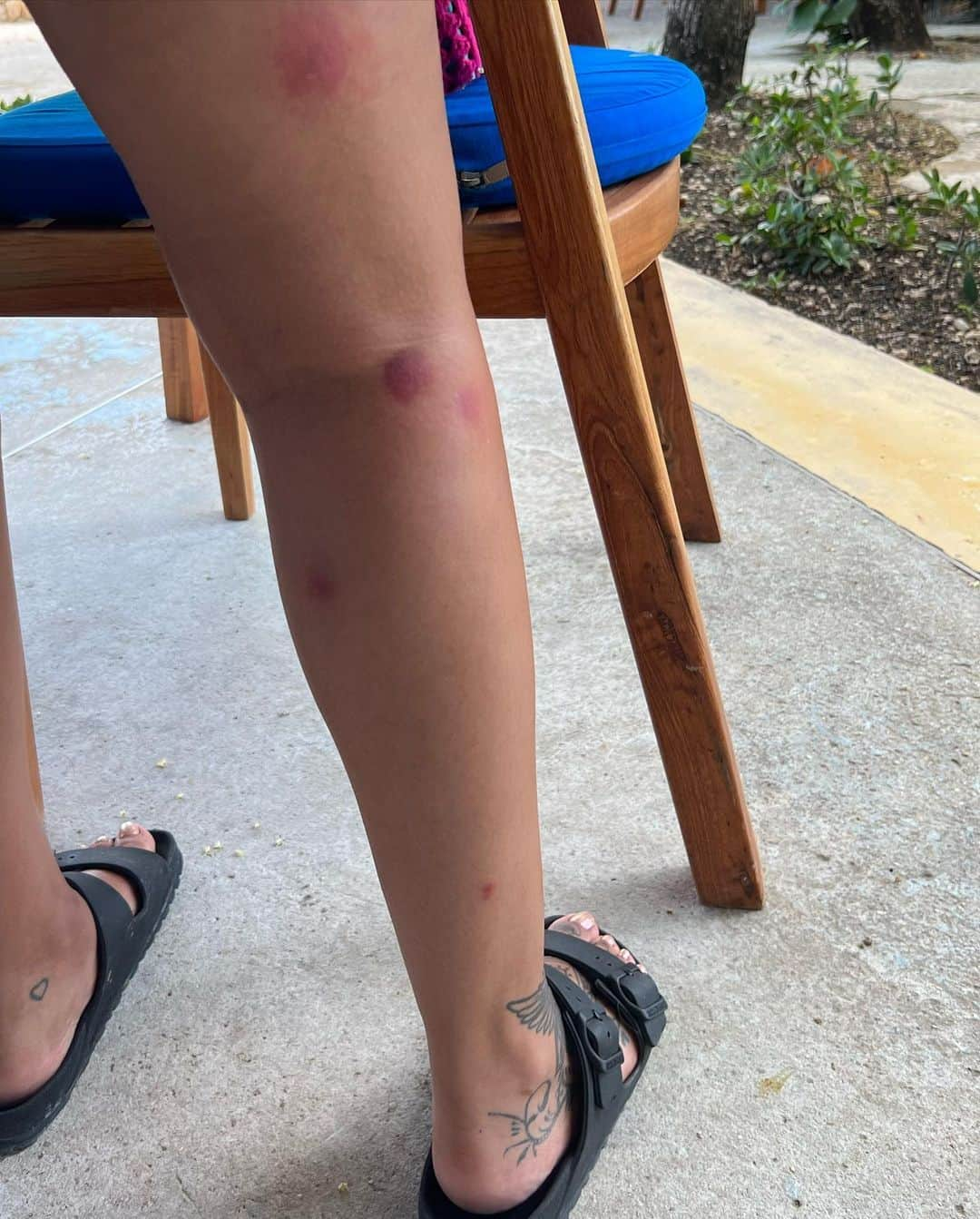 ジェイド・サールウォールさんのインスタグラム写真 - (ジェイド・サールウォールInstagram)「Turns out Jamaican mosquitos love biting me just as much as all the others 🥹🥰😏」6月18日 1時51分 - jadethirlwall