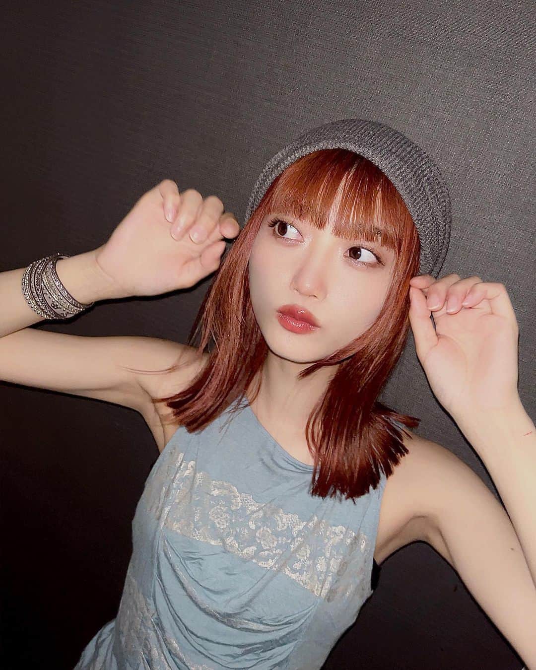 阿知波妃皇のインスタグラム：「🍈🤎 腕の傷は猫ちゃんに引っ掛かれました🥲」