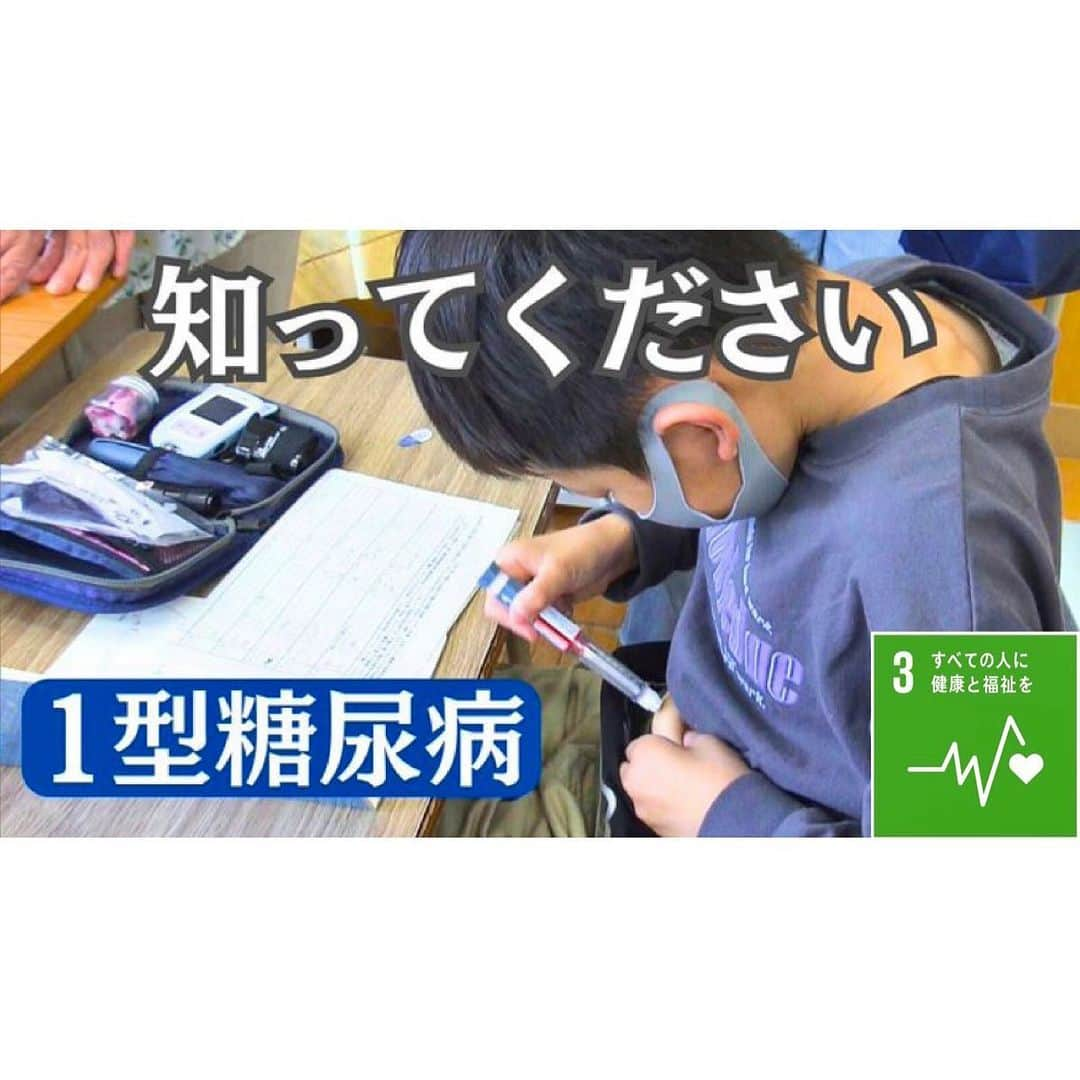 上坂嵩さんのインスタグラム写真 - (上坂嵩Instagram)「１型糖尿病とは💉 . #糖尿病 には １型と２型、 ２つのタイプがあることをご存知でしょうか？ . 日本糖尿病協会によりますと、 患者の９割近くを占めるのが「２型」。 食生活などが原因で中高年が多く発症するもので、 一般的にイメージする「糖尿病」です。 . . これに対して「１型」は、 生活習慣とは関係なく、突然発症します。 . すい臓でインスリンがつくれなくなり 血糖値が上がってしまう病気で、 #子どもに多く発症する のが特徴です。 . . 5歳の頃、「1型糖尿病」と診断された真浩くん。 . 食事の際には、毎回 #血糖値 を測定し、 #炭水化物 の量に合わせて 必要な量の #インスリン を注射しなければいけません。 . 昼夜関係なく投与が必要で、 真浩くんは、1日10回ほど注射を打っているといいます。 . インスリン注射は医療行為にあたるため 打てるのは、医師や看護師、本人か家族に限られます。 . 家庭以外の場所で定期的に行うためには #周囲の理解と協力が不可欠 です。 . しかし、メ～テレと支援団体が共同で調査したところ 発症後に保育園や小学校などから転園・転校を求められたり、 入園を断られた人が2割を超えていることがわかりました。 . まずは、理解を広げることが大切だと感じます🍀 . . きょう深夜2時からメ〜テレでは、#テレメンタリー  「いちがたっこ～給食は注射を打ってから～」を放送します。 . 深い時間ですが、是非ご覧ください。 . . #SDGs #SDGs2030 #持続可能な開発目標 #すべての人に健康と福祉を #ドキュメント #ドキュメンタリー #メーテレ #アップ #アナウンサー #フィールドキャスター #ニュースワード #SDGsビジネスマスター #上坂嵩」6月19日 19時34分 - takashi_uesaka_nbn