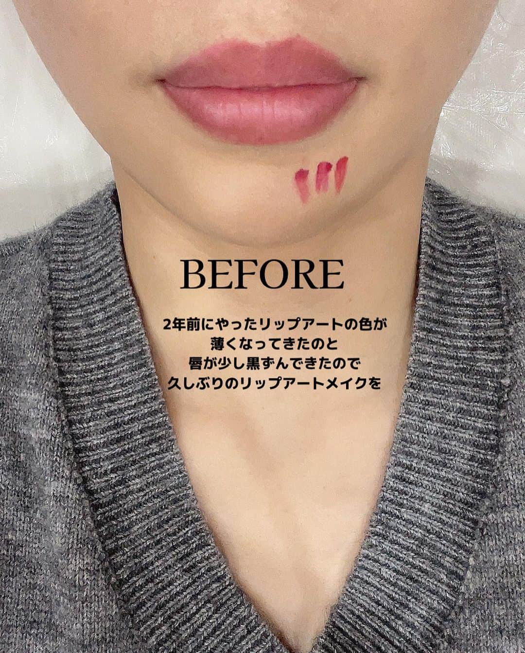 唯可（yuika）さんのインスタグラム写真 - (唯可（yuika）Instagram)「この度、2年ぶりに リップアートを施しました💋✨  とにかく痛みに弱いので前日から またあの痛みに耐えるのかと恐怖を抱いていたのですが、 まさかまさかの全然痛みに耐えられる🥹✨ という結末でほぼほぼ寝ていました🤤  そのくらいうまいってことです✨ 写真スワイプシテミテネ🤳  唇が黒ずみやすいのでオレンジ色を中に入れてもらい 薄くなった唇の色をまた濃くしてもらって 禿げてきていたオーバーリップの上の部分を 微調整してもらいました🤍  写真の5枚目にお得情報載せたので 是非是非みてみてね✨  リップアート気になってる方は保存ボタンクリックしてね👆  #アートメイク#リップアート#眉アート#リップアートメイク#ヘアメイク#メイク#唇#リップ#オーバーリップ#アラサーメイク#美容医療」6月20日 18時25分 - yu.i.k.a