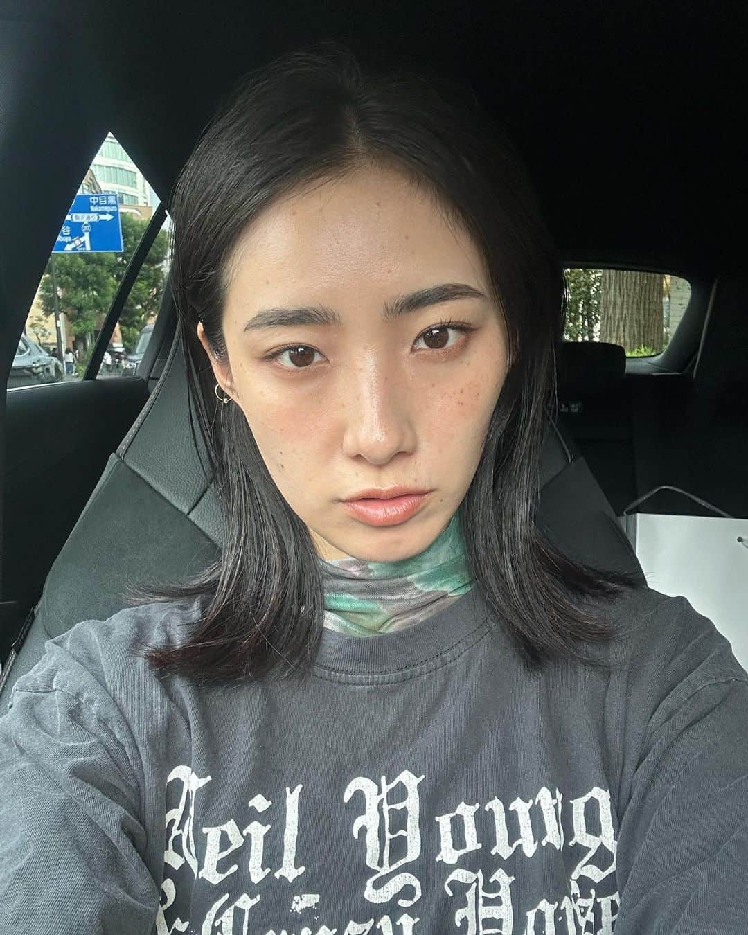 中田クルミのインスタグラム：「見事なチョコチップ顔🍪 しばらく仕事が空いたので、思い切って @nexus_clinic でシミそばかすを撃退してきました。 ・ピコスポット ・ピコトーニング ・エレクトロポレーション この3つを施術して、内服薬をまずは3ヶ月続けます。 肌診診断機で肌年齢22歳と言われましたが、浮かれてる場合ではありません。見てくださいこの隠れシミの数々を。 私は本気です。美容医療大好きマンです。  ちなみに今術後2日目で、直後の写真は4枚目です。 チョコチップ顔からの変化が楽しいので、毎日写真撮って記録してます。後日まとめてアップしたら参考になるかな🤔 酒井先生 @dr.tomoko_antiaging ありがとうございました&これからもよろしくお願いします！」