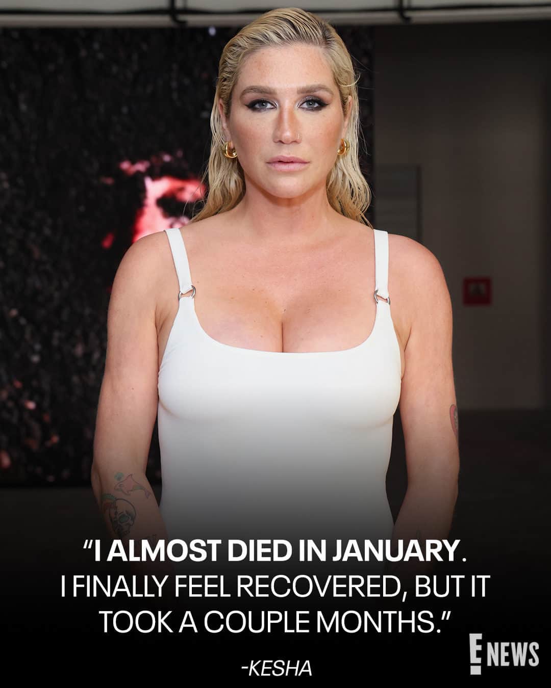 E! Onlineさんのインスタグラム写真 - (E! OnlineInstagram)「Kesha recently shared that she suffered a rare complication from an egg-freezing procedure. 🙏 She reveals the health issue that led to her complications at the link in our bio. (📷: Getty)」6月22日 4時01分 - enews