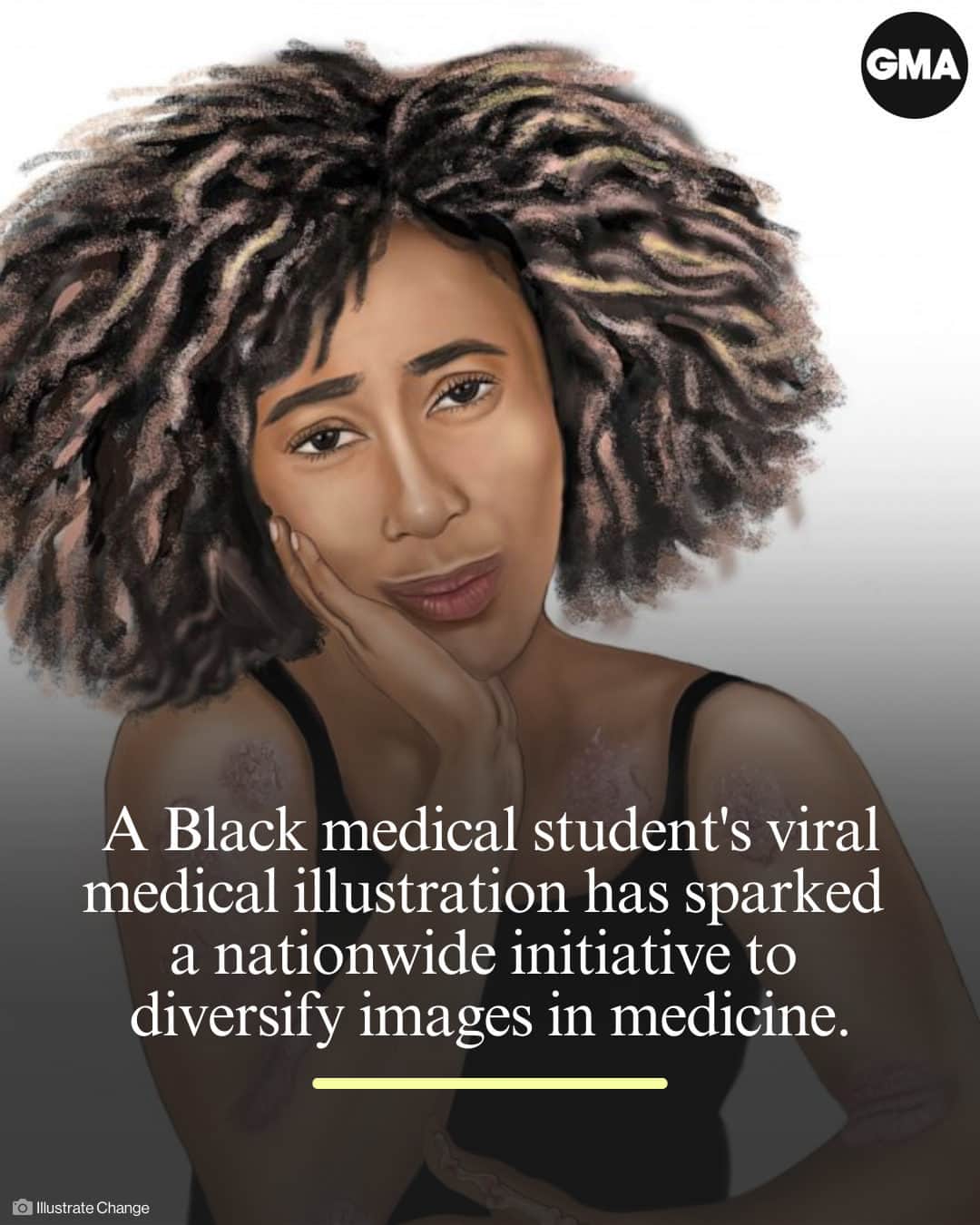 Good Morning Americaさんのインスタグラム写真 - (Good Morning AmericaInstagram)「"Health care should represent the images of people that we serve."   A Black medical student whose medical illustrations featuring a Black pregnant woman went viral in 2021 has sparked a nationwide initiative to diversify images in medicine. Learn more at our link in bio.」6月22日 6時01分 - goodmorningamerica