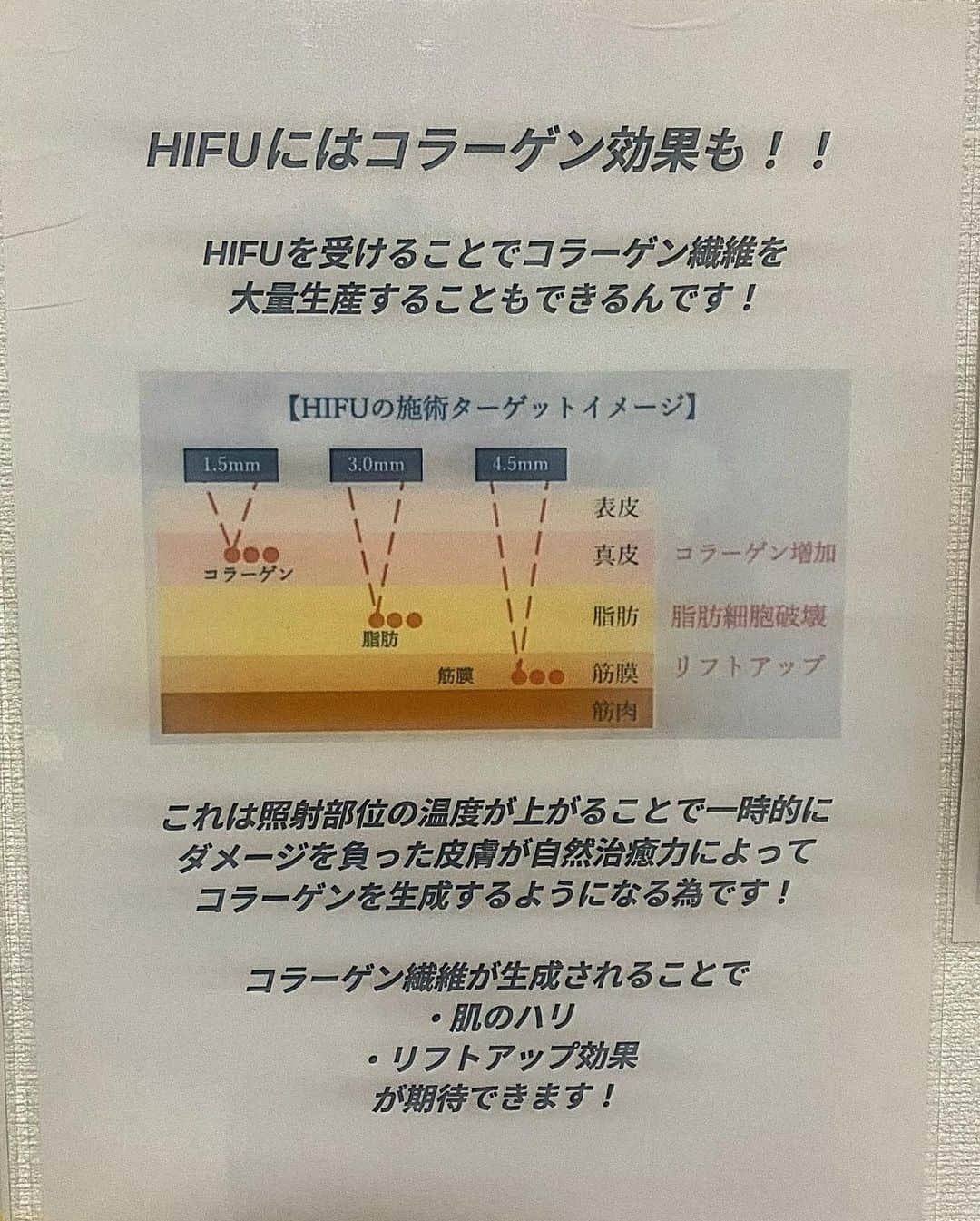 AYUNAさんのインスタグラム写真 - (AYUNAInstagram)「恵比寿にあるLULAさんで毎月の小顔メンテナンスぅ✨✨  継続したら本当に効果抜群なのです😊  ハイフは良いですよ〜☺️🍀  #ハイフ#恵比寿#ブラジリアンワックス#脱毛#美容マニア#美容オタク @lula_ebisu」7月18日 10時16分 - ayuna_0404