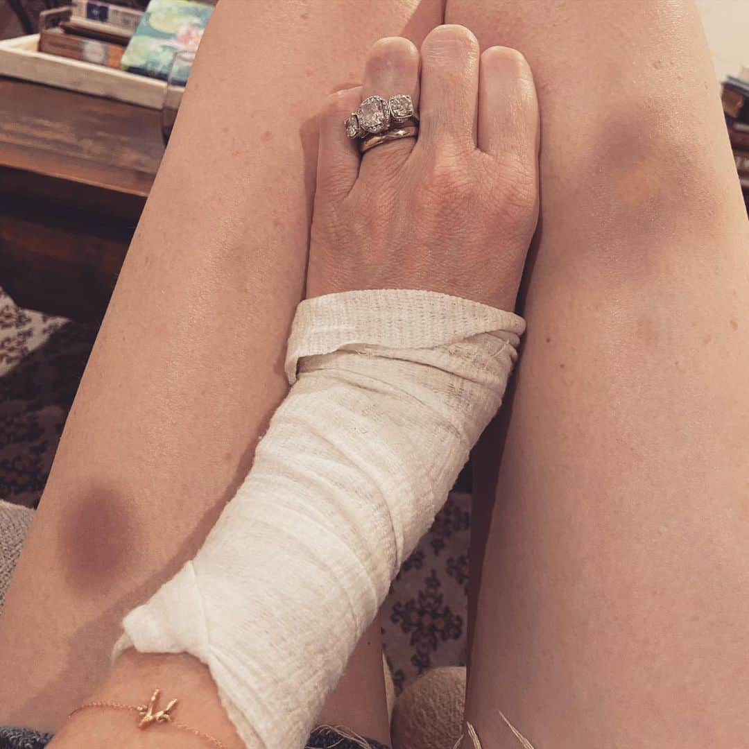 レイチェル・ニコルズのインスタグラム：「I’m doing great. Great! “Burns and bruises” - that’s my middle name. I have been a clumsy klutz since birth, so…why quit now? 😂.」