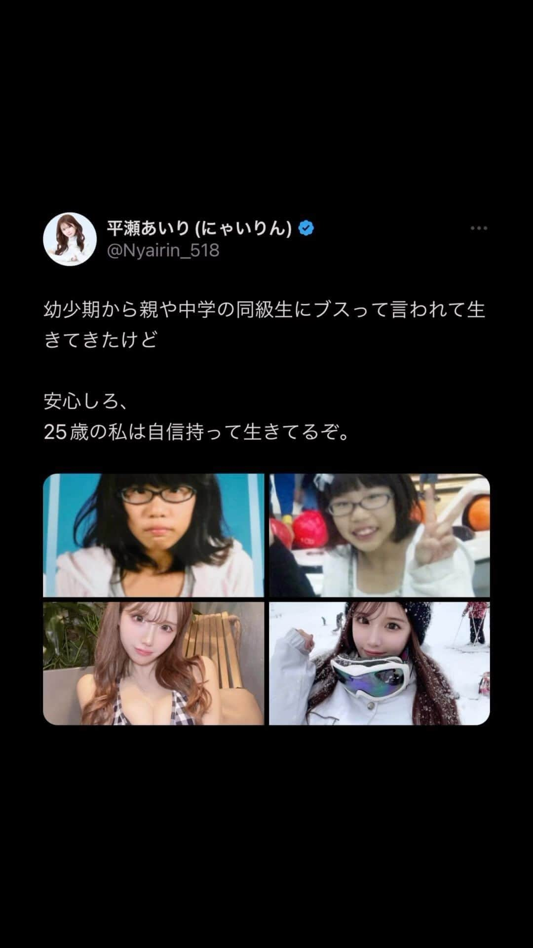 にゃいりんのインスタグラム：「幼少期から親や中学の同級生にブスって言われて生きてきたけど 安心しろ、 25歳の私は自信持って生きてるぞ。 #ツイッター #確定 #おもしろ #ツイート #平瀬あいり  #にゃいりん #tiktok」