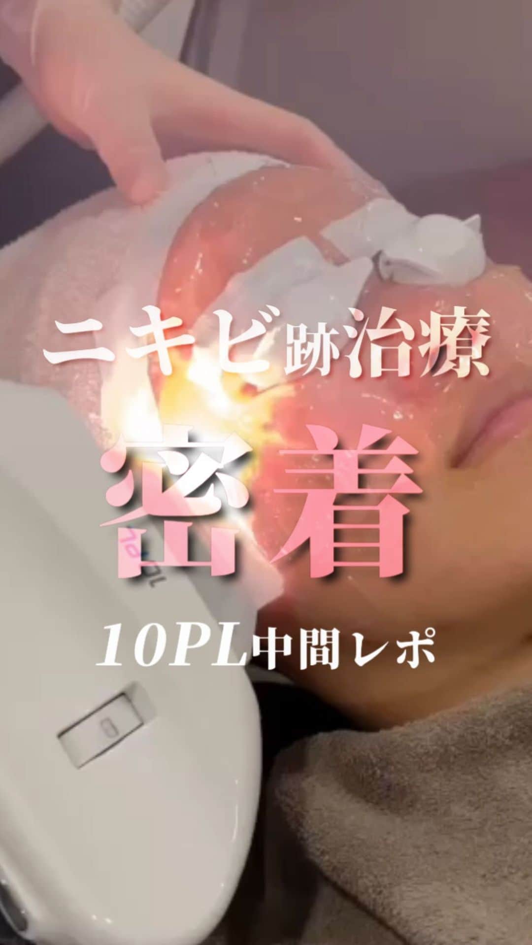 オラクル美容皮膚科東京新宿院のインスタグラム