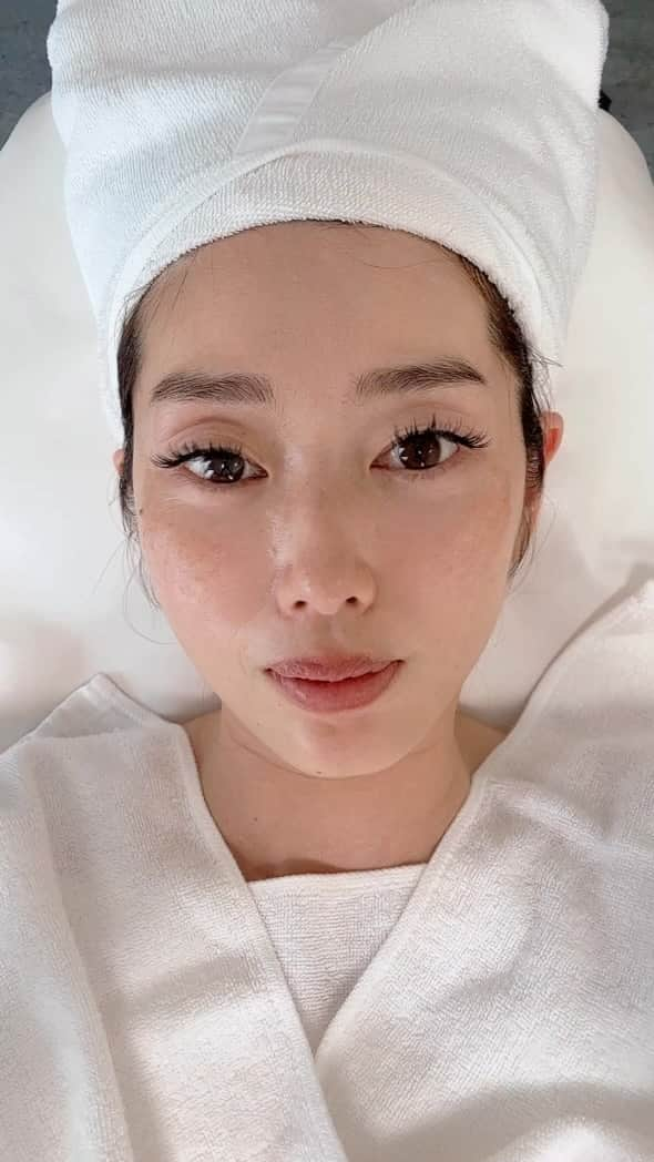 芝本裕子のインスタグラム：「先週行って来ました！ めちゃくちゃ久しぶりに @beaute.skinclinic 🩵🩵🩵 今回は、ずっと気になっている#エクソソソーム のエステ。本当は点滴したかったのですが、点滴はまた今度… まだ点滴については知識なさすぎなので、それについては今度 @chihirokaji0125 にレクチャーしてもらおう！ なので、とりあえずエステ。今回したのは、ターンオーバーを促進して肌の再生を早めるようなメニュー😂なんか、ちゃんとしたメニュー名じゃなくて、すみません😅またも、覚えられてないのです…笑 ビギナーピール(珊瑚の微細針)で穴を開けたところに、エクソソーム美容液をたっぷり浸透しさせて、 ハリ弾力のある肌を目指す‼️ピーリング施術後の保湿、鎮静を目的としてシートマスクをしてくださいました。 肌を落ち着かせ美容成分の浸透を促すトリートメント。 ちなみに、最初のピーリング…前日のサッカー観戦で日焼けしていたため、チクチクぐらいのはずが、まあまあ痛かった😅でも、これは日焼け後すぐだからで、普通の方は大丈夫🙆‍♀️まあ、痛いと言っても耐えられないような痛さではないです。 余談ですが、私産前銀座のとあるサロンで同じような針ピーリング？珊瑚じゃなくて、多分その時はサボテンだったと思うけど、その針を入れていくのを受けたんですが、痛すぎて悶絶…さすがに途中で、もう無理です！って言った😅そんなこんなを経験してるから、今回のなんて、余裕でした。  そしてそして、結果としては、当日はもちろんぷるんぷるん。ちくちくはちょっと残ってます。洗顔とかすると、ちくちくが少し感じるぐらい。1週間経って思うことは、パーっと張った感じではなくて、弾力がとってもアップしたと思います‼️これをキープすべく、ホームケアもがんばります‼️  #夏のスキンケア #夏に向けて #エステ #エクソソソーム #六甲道 #六甲道エステ #美容オタク #美容家 #shiba_u」