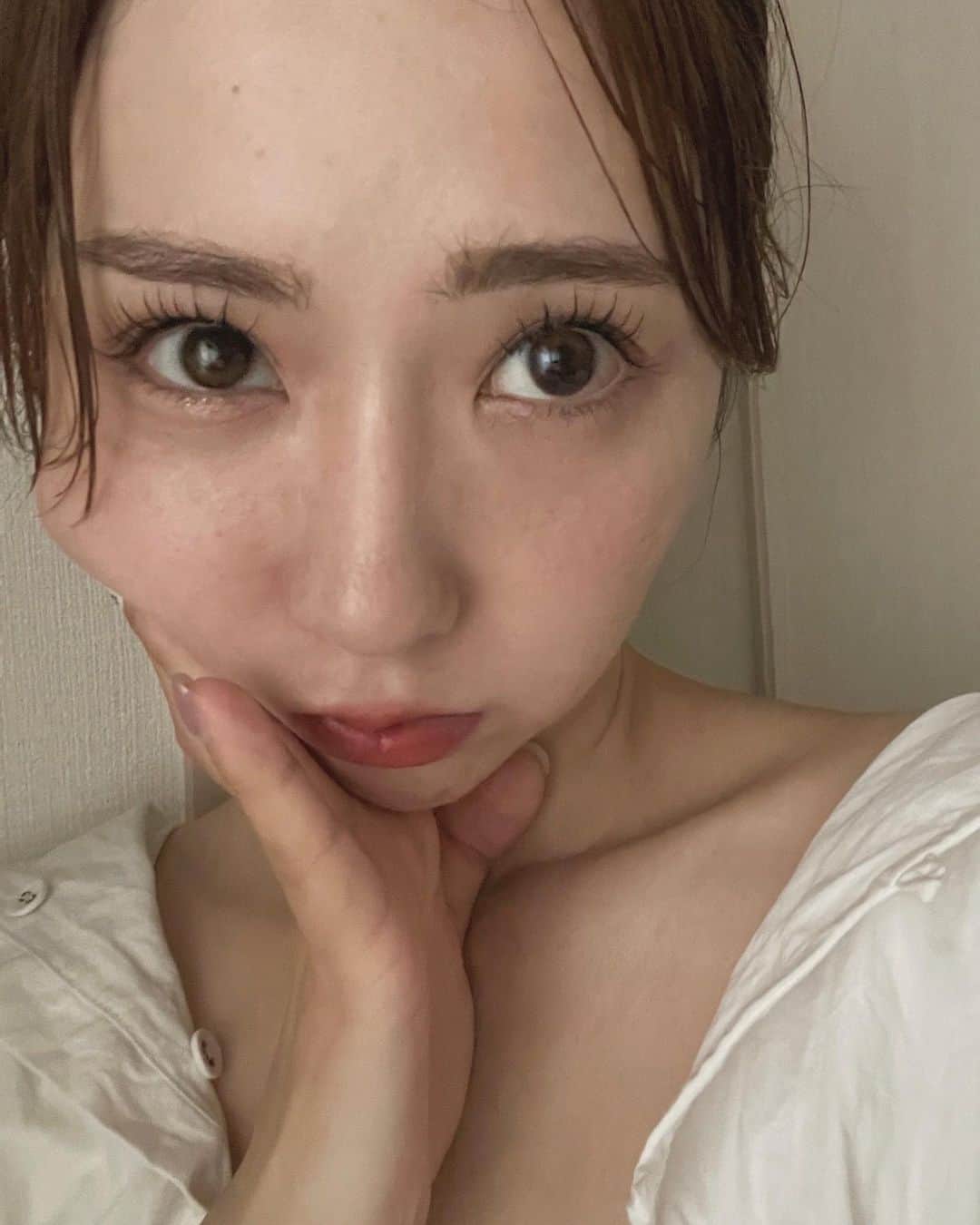 のインスタグラム：「シミそばかすと肝斑治療のために月1で通い続けている @dr.tomoko_antiaging 先生の @nexus_clinic でのピコトーニングに、先月末も🔦  ニキビが大量発生してしまっていたので ポテンツァのニキビショットもお願いしたの ✸ 炎症してから数日経った根深いものから 小さい白ニキビまで くまなく打っていただいた🔫  👉🏼 3枚目の動画は打った直後 蚊に刺されたみたいに膨らんで赤みが出ているけど一時的なもの 👉🏼 4枚目は打った翌日 腫れが引き、大きめだったニキビは小さくなって瘡蓋状に。  打って速攻治るわけではないけど、治りのスピードが全然違うし ニキビ跡をつくらず綺麗に治せるから、ニキビができたら必ず受ける施術! 一度打ったところは皮脂腺が消滅するから二度とニキビができなくなるし🫶🏼  それにしても最近肌の治安が悪化していてつらい 今年もこの季節がきたかってかんじ... ふだんはニキビがそんなにできない肌質なのだけど、毎年夏になると発生するんだあㅜㅜ 皮脂分泌が過剰になるせいで。 ナースの @hikari_nurse さんと話していたら 皮脂腺や汗腺の働きを抑えるマイクロボトックスを顔面に打つと、だいぶ夏の肌悩みが改善できると教えていただいたので、次回打つ予定💉 ჱ̒⸝⸝•̀֊•́⸝⸝)  #nexusclinic」