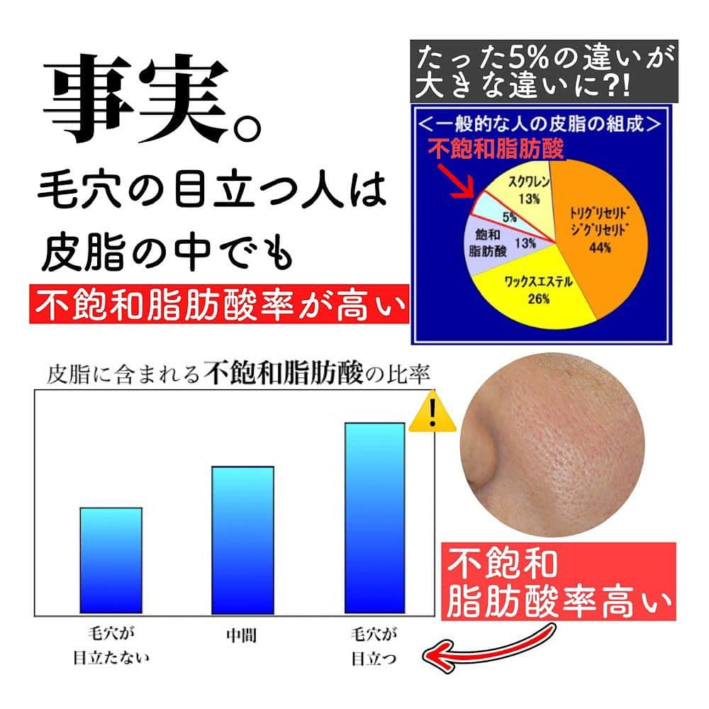化粧品子さんのインスタグラム写真 - (化粧品子Instagram)「化粧品成分一級スペシャリストおすすめ成分情報。資生堂が約4年の歳月をかけて日本で初めて「毛穴縮小効果」を見出した成分。 その名も グリシルグリシン グリシルグリシンの研究の成果は 世界中の研究者が成果発表する研究大会「IFSCC」でもっとも名誉ある 最優秀賞を獲得*🏆  特許登録番号 5241058（2013/4/12登録）  *IFSCC Congress 2006 第24回  大阪大会 最優秀賞  🧪この研究はどれくらいスゴイの？ 女性のお悩みトップ3に入る悩みが毛穴の 悩み。昔は皮脂を取ればいいと思っていました。しかし、ただ皮脂を取るだけでは 毛穴悩みは解決しないのです⚠️  資生堂は100種類以上の皮脂成分を研究し、 「毛穴の開き」の実態を明らかに 毛穴の目立ちを整える研究に 約4年の歳月をかけて たどり着いた答えがこちら👇  ⚠️毛穴の目立つ人の皮脂には 不飽和脂肪酸が多く存在していた！⚠️  この不飽和脂肪酸は、ヒト皮膚の皮脂の約5%に含まれる成分で 細胞内のイオンバランスを乱し炎症を引き起こす物質の産生を促してしまう。  そうなると、ターンオーバーが乱れ、 すり鉢状の開き毛穴になってしまうんです。 開き毛穴は、毛穴の奥が詰まって 目立っているのではなく、  【毛穴が目立つ肌は毛穴部分が すり鉢状に凹んでいる事を解明🔎】  しかも何万とある中からグリシルグリシンを発見し、 毛穴縮小や角層の水分量がアップする効果を見出した素晴らしい成分。  まずはグリシルグリシンで検索したり、 店頭の成分を見抜くポイントとして 「グリシルグリシン」はマストで 覚えてほしい成分！  成分を知ってコスパよく綺麗になりましょう！  #グリシルグリシン #毛穴悩み #成分解析 #資生堂#PR#毛穴#毛穴ケア#たるみ毛穴#毛穴の黒ずみ#化粧品子」7月4日 18時43分 - keshouhinko1225
