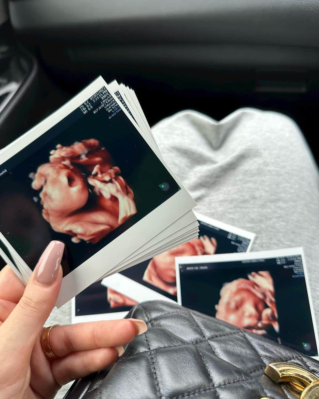 𝐓𝐒𝐔𝐊𝐀𝐒𝐀さんのインスタグラム写真 - (𝐓𝐒𝐔𝐊𝐀𝐒𝐀Instagram)「Hi baby👶🏻🤍 28w0dの日  妊娠後期に突入したので4dエコーしにいってきた☁️ 👨🏽といっしょにかわいい言いながら一緒に見れて幸せ空間でした🌱  ぷくぷくほっぺにぷっくり唇、お鼻も全部可愛い✊🏼 . . #4dエコー #妊娠8ヶ月 #妊娠後期 #初マタ #ぷんにー #マタニティライフ」7月4日 20時50分 - tsukasa_xoxo