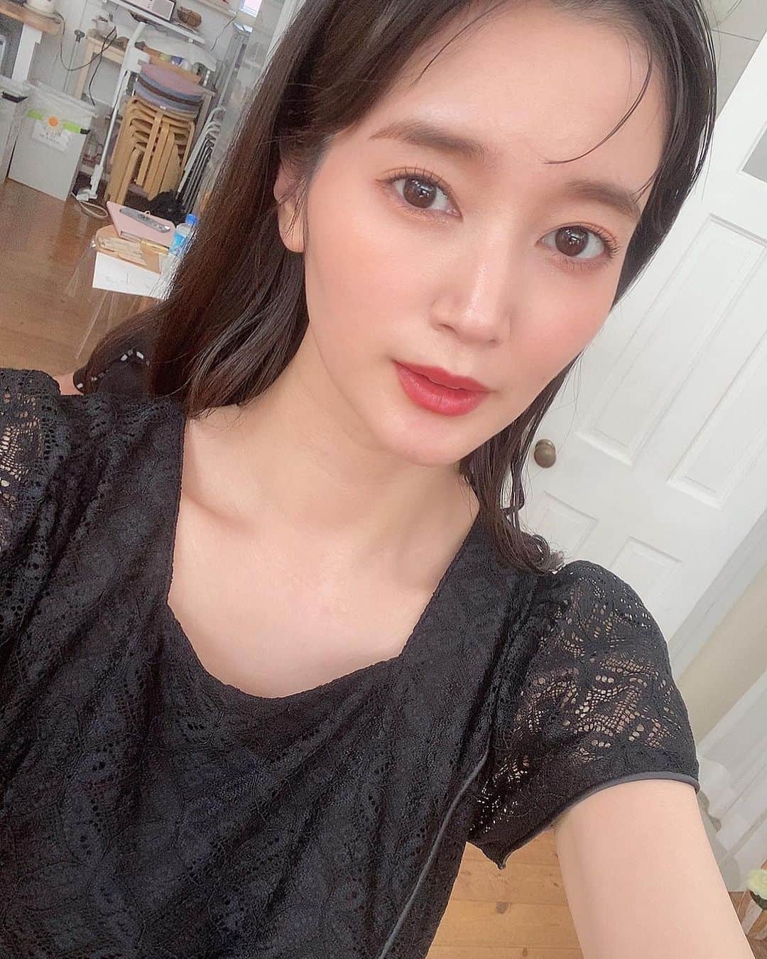 出口亜梨沙のインスタグラム：「A CLINIC (@a_clinic_ginza )でしてもらったAスレッドめちゃくちゃいい感じに引き上がってる😳 だいぶ上げてもらったんだ😌  久しぶりだったからすごく緊張したけど、長谷川先生(@aclinic_hasegawa )が色んな話をしてくれてリラックスできたから大丈夫だった😭✨  フェイスラインのもたつきが気になってたけどそれが無くなった😳！ フェイスラインのたるみとかもたつきほうれい線に悩んでる人にはオススメだよ😌  PRP血小板療法が良いって聞いたから今度はそれもしてみたいな😆  #aスレッド #糸リフト #aclinic #aclinic銀座 #aclinic横浜 #aclinic新宿 #aclinic仙台 #aclinic名古屋 #aclinic大阪 #aclinic福岡  #aclinic池袋 #aクリニック #エークリニック#小顔 #リフトアップ #スレッドリフト #小顔整形 #たるみ改善 #美容外科 #美容皮膚科 #美容クリニック #長谷川光」