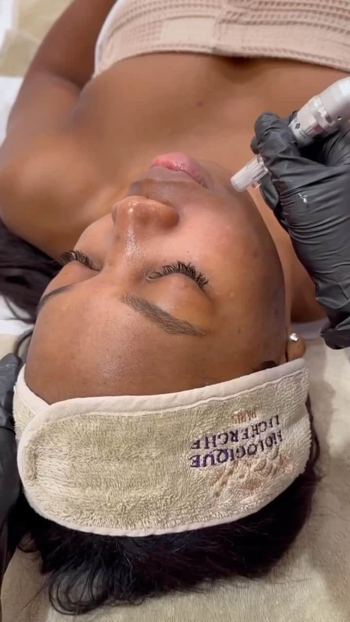 Biologique Recherche USAのインスタグラム：「Micro-Puncture Lab© treatment at @luxbae ✨  •••   Camai already has beautiful skin but we wanted to take it to the next level with a series of micro-puncture sessions! This unique microneedling device by Biologique Recherche stimulates collagen, elastin, and hyaluronic acid production while infusing the skin with a cocktail of vitamins.  To prep the skin, we use Biologique’s Eau Micellaire Biosensible✨ — a supercharged micellar based cleanser that dissolves all traces of makeup, dirt, pollution and grime. And of course we follow it up with Lotion P50✨ to tone and balance the pH of the skin.  Micro-Puncture© features a vibrating needle with customizable depths from 0.25mm to 2mm. It offers many more benefits than ordinary microneedling because it isn’t only causing micro-injuries to her skin which stimulate collagen production, it’s also infusing her skin with different vitamins & growth factors at the same time. The serum we use is Biologique’s Cocktail d’actifs Régénérants✨ which is a concentrate of 56 regenerating, revitalizing, stimulating and energizing active ingredients derived from the most advanced biotechnology — including vitamins B, E, C and A, amino acids and special polypeptides.  This microneedling device works to activate cellular regeneration to prevent and reduce signs of aging, protect against the harmful effects of free radicals, and boost the skin’s protective functions while improving epidermal moisture and tone. You can expect to see firm, plump skin and a refined skin texture after this treatment. Fine lines and wrinkles will be reduced as well as dark spots and other surface imperfections.   Reel: @luxbae ( @embodybycam )  #BiologiqueRecherche #FollowYourSkinInstant #BuildingBetterSkin #radiantskin #micropuncturelab #microneedling #cocktaildactifsregenerants」