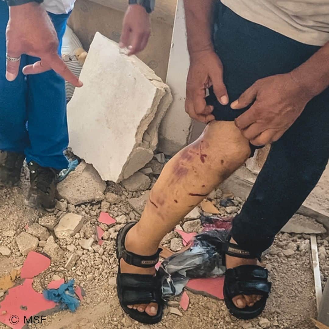 国境なき医師団さんのインスタグラム写真 - (国境なき医師団Instagram)「【ジェニン難民キャンプ　緊急報告】  イスラエルの軍事作戦で12人が死亡したパレスチナ自治区ジェニンで、国境なき医師団（MSF）が現地の医療ニーズの調査を行いました。  スタッフが見たものは、完全に破壊された民家や、兵士に自宅を襲われた人、持病を抱えたまま薬を必要とする人たちでした。  キャンプのある住民はMSFに、兵士が10時間にわたって自宅を占拠したと語りました。 「軍の犬が私に飛びかかり床に倒れましたが、兵士らは笑うだけでした。私は63歳で、高血糖だと訴えましたが、薬を飲ませてもらえるのに2時間かかりました」  5人家族で暮らすサラムさんも同様の経験をしました。 「深夜1時に家のドアが爆破され兵士たちが入ってきたのです。私たちに銃を向け、勝手に食料を食べたりトランプに興じたりして16時間も居座りました。その間、軍の犬が私や3人の娘を威嚇していました」  3日間続いたイスラエル軍の攻撃。MSFはジェニン難民キャンプ内で活動するコミュニティ救急隊に、緊急・外傷用物資を寄贈しています。  #国境なき医師団 #MSF #パレスチナ #ジェニン #医療援助 #緊急援助」7月7日 14時13分 - msf_japan