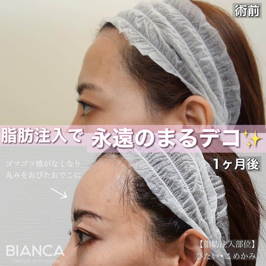 辻沢由有（BIANCA CLNIC 表参道院 院長）のインスタグラム