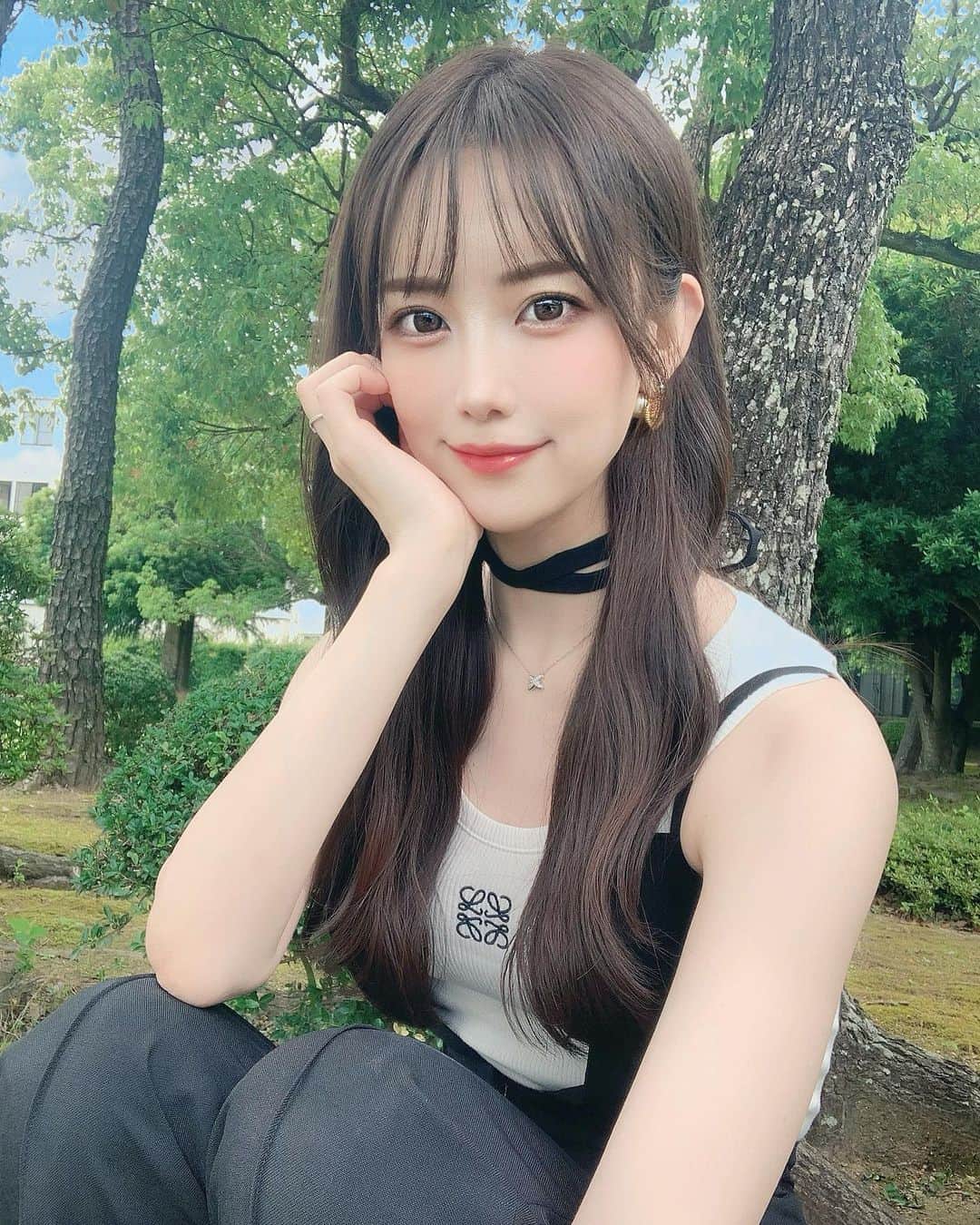 鈴木 あやのインスタグラム：「. おでこの経過報告🕊️🤍  担当は福山先生👨🏻‍⚕️ @sbc_fukku_antiaging  @sbc_yokkaichi  ダウンタイムという程の 辛いダウンタイムは全然なくて おでこの痛みはもう全く無い🙆🏻‍♀️  太もものアザも消えました🫶🏻  脂肪の定着率は25%って言われてるから もう少し無くなるかもだけどいまのとこ やって良かったと思ってる😚♥️  #湘南美容クリニック #湘南美容クリニック四日市院 #美容クリニック #脂肪注入 #美容」