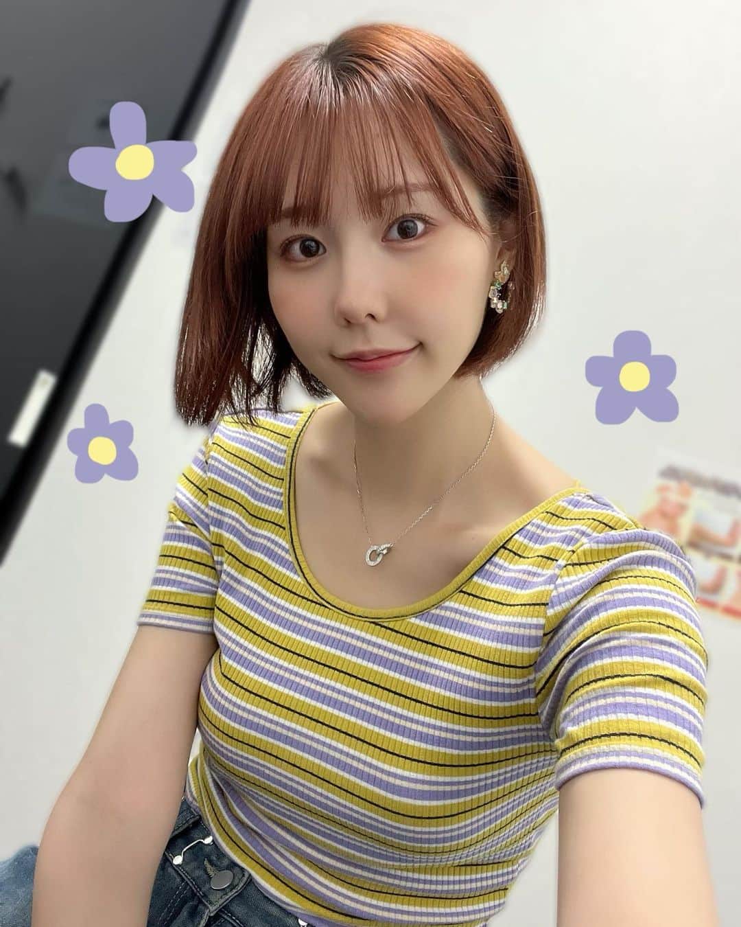 のインスタグラム：「東京中央美容外科千葉東口院さん（@tcb_chibahigashi）で でTCB式小顔美肌再生を受けてきたよん😚✨ 担当は根本先生！（@tcb_nemoto_naohisa） 最近口角の横のほうれい線がめちゃくちゃ気になってたから綺麗になって嬉しい😭😭😭🫰やった当日から腫れもぜんぜん無くて、友達にも肌ピカピカでめっちゃ良いやん！って言われた嬉しい☺️ 施術中ちょっぴり怖かったけど、優しい看護師さんが肩をずっとトントンしてくれてたから頑張れた🥺💪❤️‍🔥 これから更に馴染んでくらしいから楽しみ🤭  #PR #東京中央美容外科 #千葉 #糸リフト #小顔整形 #TCB式小顔美肌再生」