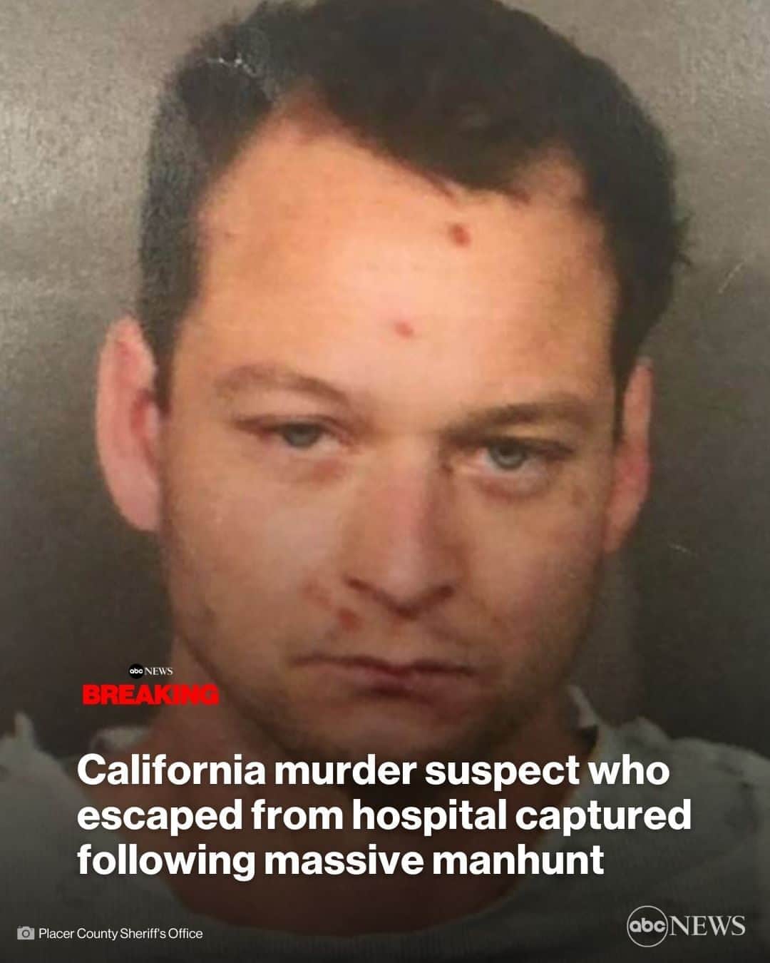 ABC Newsのインスタグラム：「A murder suspect who escaped from a Northern California medical facility has been captured following a massive manhunt, authorities say. MORE AT LINK IN BIO.」