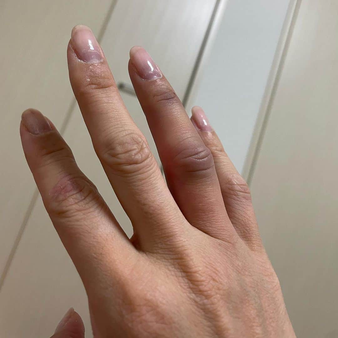 小林由佳さんのインスタグラム写真 - (小林由佳Instagram)「薬指、突き指して結構経つのに良くならない😅 #ケガ #突き指 #痛い #回復 #遅い」7月11日 10時59分 - ykp_qkb