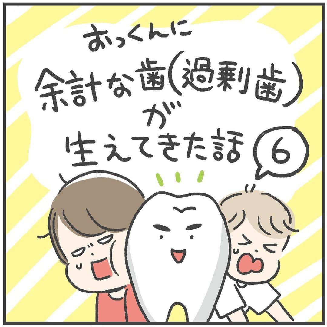 あきばさやかのインスタグラム：「治療直後だけ痛み止めを飲みましが、翌日からは全く平気そう！✨ 翌日にはハイチュウ食べていました（いいのか！？） ⁡ 今では穴もほぼ完全に塞がりました😳✨ ⁡ 過剰歯のせいで乳歯が早く抜けたのですが、レントゲンで見ると永久歯はまだけっこう奥の方。 あとはいずれまっすぐ生えてくるのを祈るのみです🙏 今年七五三撮影のおっくん、歯抜け状態での撮影は免れなそうです！（それはそれでかわいい）🦷 ⁡ 永久歯の先天性欠損も、ひとまずはもう少し様子を見ることになりました〜！ ⁡ 今回のシリーズ、コメントで同じように過剰歯や永久歯の先天性欠損の方の体験談を聞けたのがすごく心強かったです！！本当にありがとうございます〜〜！🙌 その後なにか経過があればまたご報告しますね🥳  ⁡ #過剰歯 #永久歯の先天性欠如 #育児漫画 #5歳 #育児マンガ #子育て絵日記 #育児絵日記 #絵日記 #育児記録 #イラストエッセイ #育児日記」