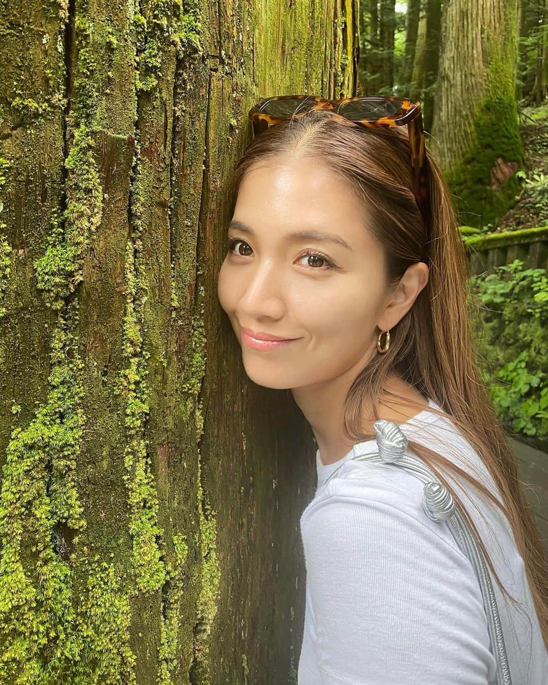 のインスタグラム：「BB弾物語🔫完🌟 （長いです！）  ちょうど1週間前ものもらいの手術をし 本日無事に抜糸がおわりました。  たくさんの方々がとんでもなく私ごとのものもらいにコメントをくださり 本当に暖かい気持ちをもらいました。 そして1か月ちょっとの自分的闘いが終わりを迎えます。 （どこまでも大袈裟）  お約束をお断りしなくちゃいけなかったことや、事情お伝えして伺っても1人1人にご説明は難しく、気づいてうつるのかな？とご心配をおかけしてしまったであろうこと。  やっと終わるとホッとしています。  たかがものもらいだけど やっぱりテンション下がっていたのは今だから思えること😄 どんなに目を開けても半眼でお化粧も決まらないし、何度自分に 起きて💭とおもったことか🫥  ものもらいになっている方も以外と多いのだと知り、その後の経過も教えてくださいとおっしゃる方もいらしたので、ここで最後までご報告したいと思いました。 （やっぱりとても大袈裟）  私の見解。 とにかく早くお医者に行って、 霰粒腫なら処方箋で様子みて それでも変化なしか大きくなるなら 取るのが1番早い！  私は多分40日近くものもらいと同居しましたが、その時間はなくていいなと思いました😄  ちなみに手術は私は表からのみだったのでこれには神様ありがとう！ 瞼表からの麻酔注射のみだったので 注射はそこそこ痛みありますがぜんぜん問題なかったです。 （私は極度の痛がりです）  2歳のお子様は麻酔ができずそのまま手術を行なったこと🥺手術の前はこの事を思い出して拳握りしめてました🤛 点眼の麻酔をたくさんするのでそこも安心材料。 術後、私は眼球の内出血もあり、ちょっとホラーな目にはなりましたが、あんじょの気持ちの方が大きかったかな。 とても学びになりました📖  写真は抜糸前の糸が残った最後の写真🤳  声をかけてくれた皆様ほんとうにありがとう。 優しい行いは世界を救います。 みんなに教わりました。  明日からまたセルフィ撮れます！☜え。  瞼も変形しなかったし、 とにかく終わって良かったです🩷✌️ ほんとうにありがとうございました。  _______________________________________________  #love #life #loveislove #thankful #🩷」