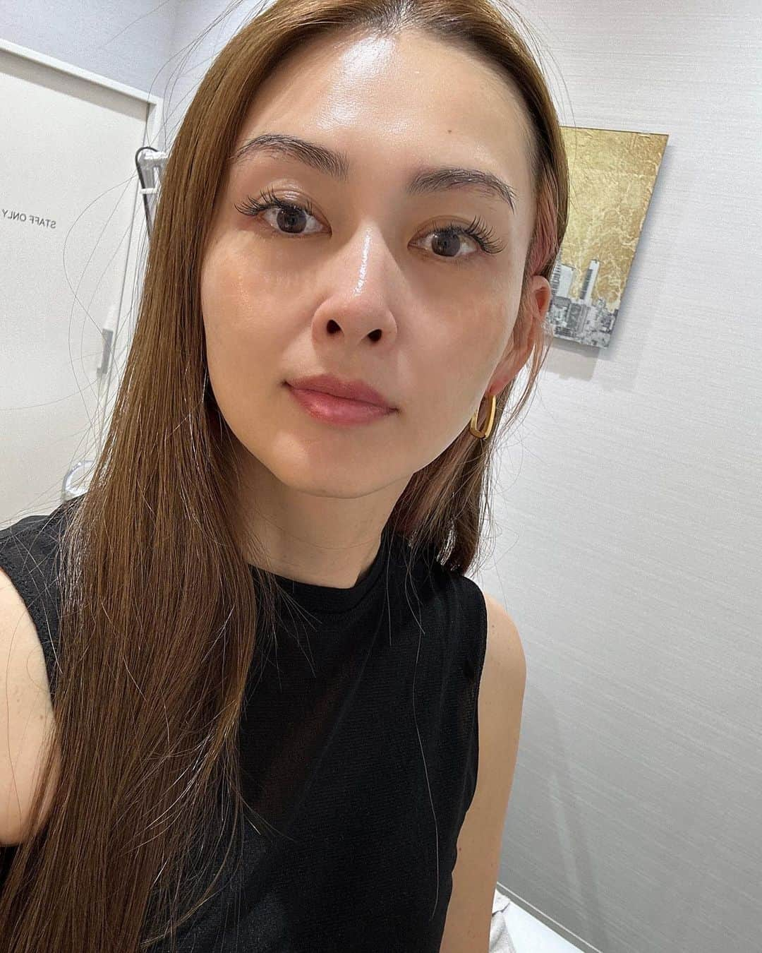 桜井裕美さんのインスタグラム写真 - (桜井裕美Instagram)「先日 @met_beauty_clinic でお肌チェック&お肌ケアをしてもらって来ましたー！！  お肌がワントーン明るくなりました！！  シミやシワ、くすみが気になる年頃😅 色々とケアが必要だな💦  #肌ケア #美容クリニック」7月11日 22時14分 - yumisakurai24