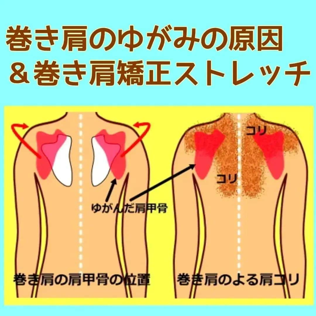 中目黒整体レメディオ 院長　渡邉潤一のインスタグラム：「姿勢が悪く巻き肩は、肩甲骨が正常な位置から八の字のように外側に開き、肩関節はみぞうちに向かってねじれます。  それにより肩甲骨と背骨の間にある筋肉が引き伸ばされたことで緊張し硬くなります。  この部分の筋肉が硬くなると姿勢が悪くなるばかりでなく、肩甲骨と肩甲骨の間にある代謝を高める褐色脂肪細胞の機能が低下し代謝が下がってしまいます。  また胸の部分では、巻き肩になったことで大胸筋や小胸筋などの筋肉が硬くなります。  結果、筋肉が弱くなり胸を引き上げる能力が下がるため、年齢とは関係なく胸がたれてしまいます。  上記のことをふまえて考えると、姿勢が悪く巻き肩の状態は、健康面・美容面に多くの悪影響を及ぼします。  姿勢が悪く巻き肩の方は、普段から背筋を伸ばし肩甲骨どうしを内側に引き寄せるように心掛けてください。  ただし、意識し過ぎてやりすぎるてしまうと、かえって背中や腰、首がわるくなる恐れがありますので、あくまでも、少しだけ引き寄せるががポイントになります。 . . . ーーーーーーーーーーーーーーーーーーーーー  💮施術のご案内💮 中目黒整体レメディオ：骨盤・美脚コース 施術をご希望の方は、はHPの予約フォームか、 お電話（0357735977）にてご連絡ください。  ーーーーーーーーーーーーーーーーーーーーー  #大転子 #大転子矯正 #o脚 #x脚 #膝下o脚 #XO脚 #骨格矯正 #骨盤 #産後の骨盤 #下半身太り #ダイエット #太もも #ふくらはぎ #反り膝  #反り腰 #骨盤の歪み #整体 #レメディオ #姿勢矯正 #中目黒整体レメディオ #骨格診断 #脚痩せ #巻き肩」