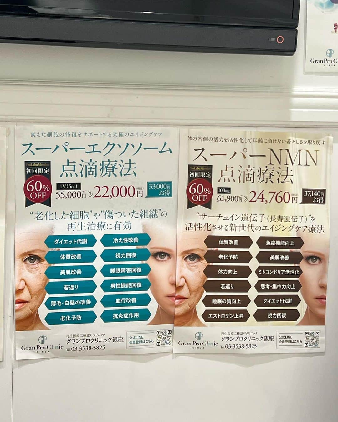 庄司ゆうこさんのインスタグラム写真 - (庄司ゆうこInstagram)「@granproclinic_ginza グランプロクリニック銀座で、エクソソーム点滴をしてきたよ✨🥰 2回目は2週間後にやるのがベストということで2週間後にやってみたけど、1回目より睡眠の質が上がったのと、 とにかく元気になった！笑 点滴のあと、3日連続ゴルフしたけど体力的に心配でしたが、まだまだ行ける勢いで３日間炎天下でしたが、めちゃくちゃ元気に楽しめました🤣💓 そして点滴と合わせて @medicalspa_granpro グランプロメディカルスパで、フォースカッターと筋肉運動のマシンをあててもらいました❣️ フォースカッターは気になる部位の深い脂肪組織やセルライトまで届く熱エネルギーが浸透し、脂肪やセルライトにアプローチできるそうです✨さらに、血液やリンパの流れを促しむくみや冷え症、肩こり、腸の調子を整えるなどいろんな不調を改善する効果もあるみたい🤗 温かくて気持ちよくてウトウトしちゃいました🤗 また来月も点滴とフォースカッター同時に予約しよっと(^^) #点滴#エクソソーム #培養上清液 #銀座#クリニック#エステ#美容好きな人と繋がりたい#アラフォー#アラフォーママ」7月12日 23時43分 - yuko.shoji