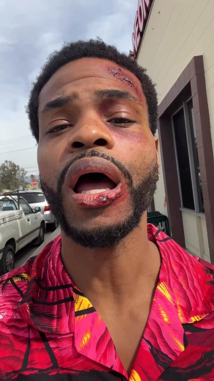 King Bachのインスタグラム：「Ouch 🎤」