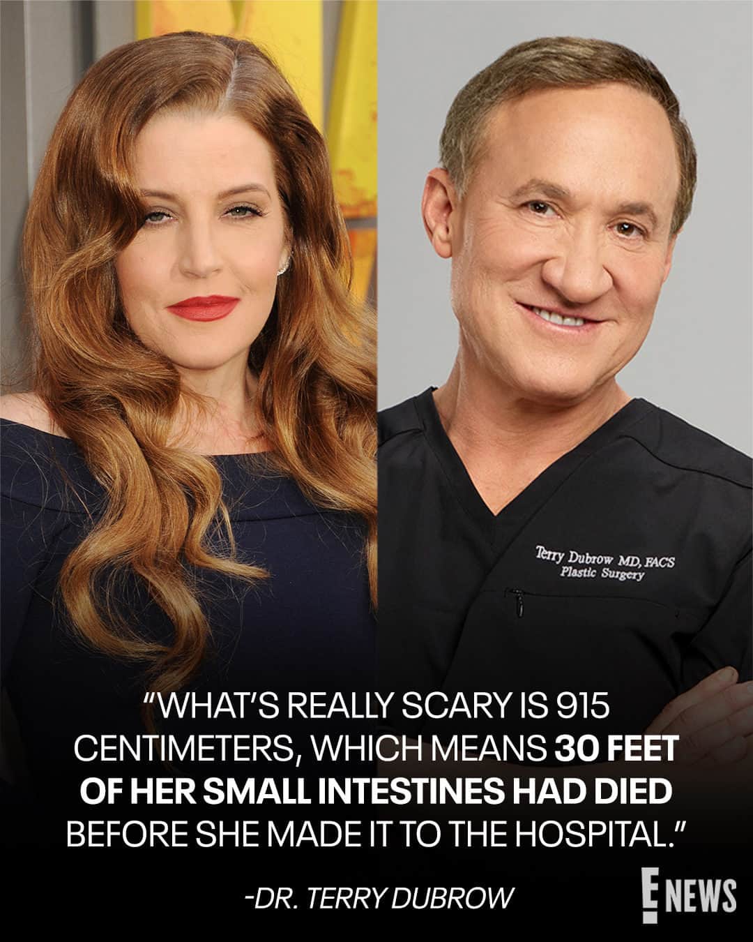 E! Onlineさんのインスタグラム写真 - (E! OnlineInstagram)「Following Lisa Marie Presley's death, Dr. Terry Dubrow is explaining the potential risks of weight loss surgeries. He shares what he learned from her autopsy report at the link in bio. (📷: Getty/NBC)」7月15日 12時00分 - enews