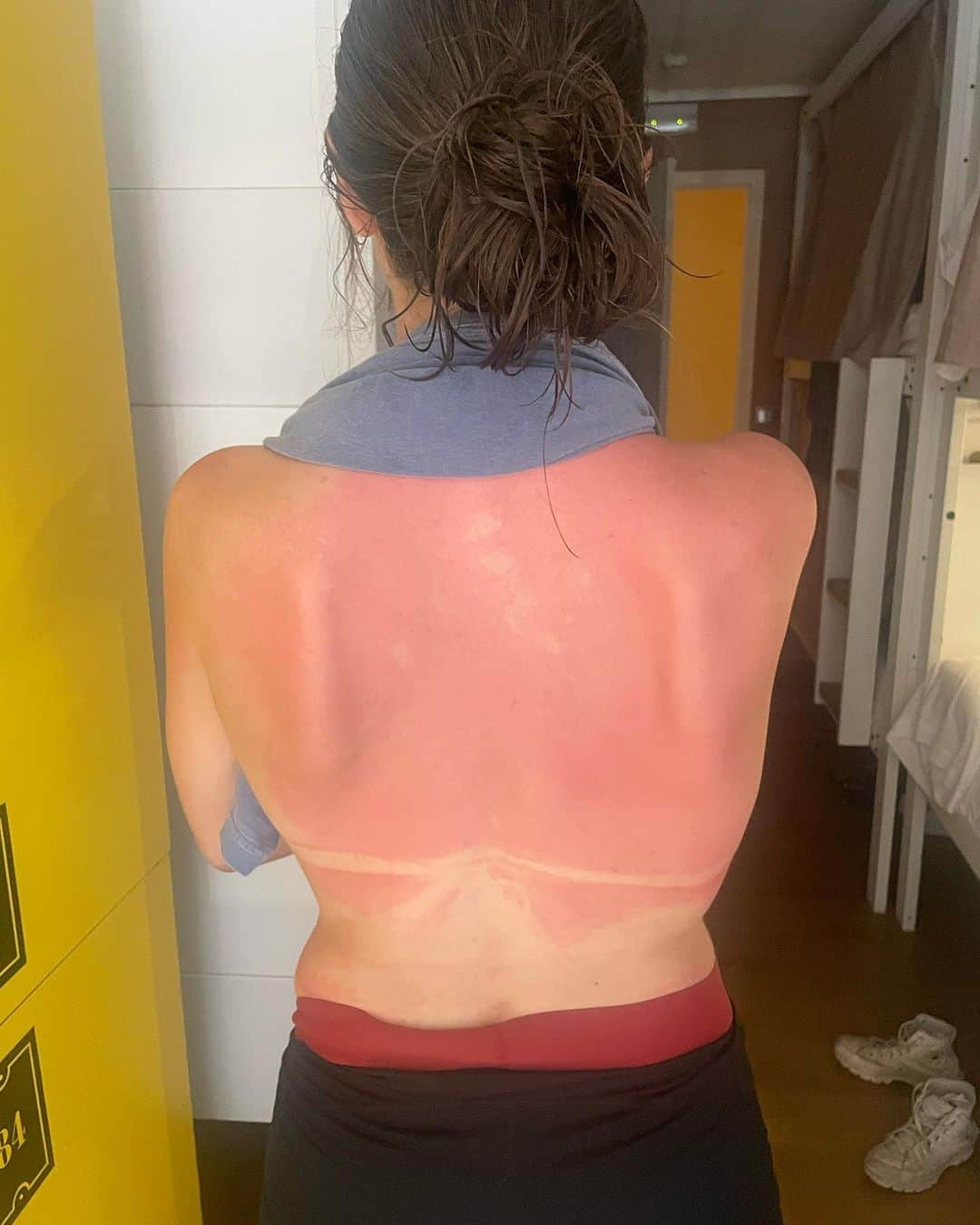 ペイトン・アーンストさんのインスタグラム写真 - (ペイトン・アーンストInstagram)「I clearly don’t know how to put sunscreen on…」7月17日 0時12分 - peytonernst