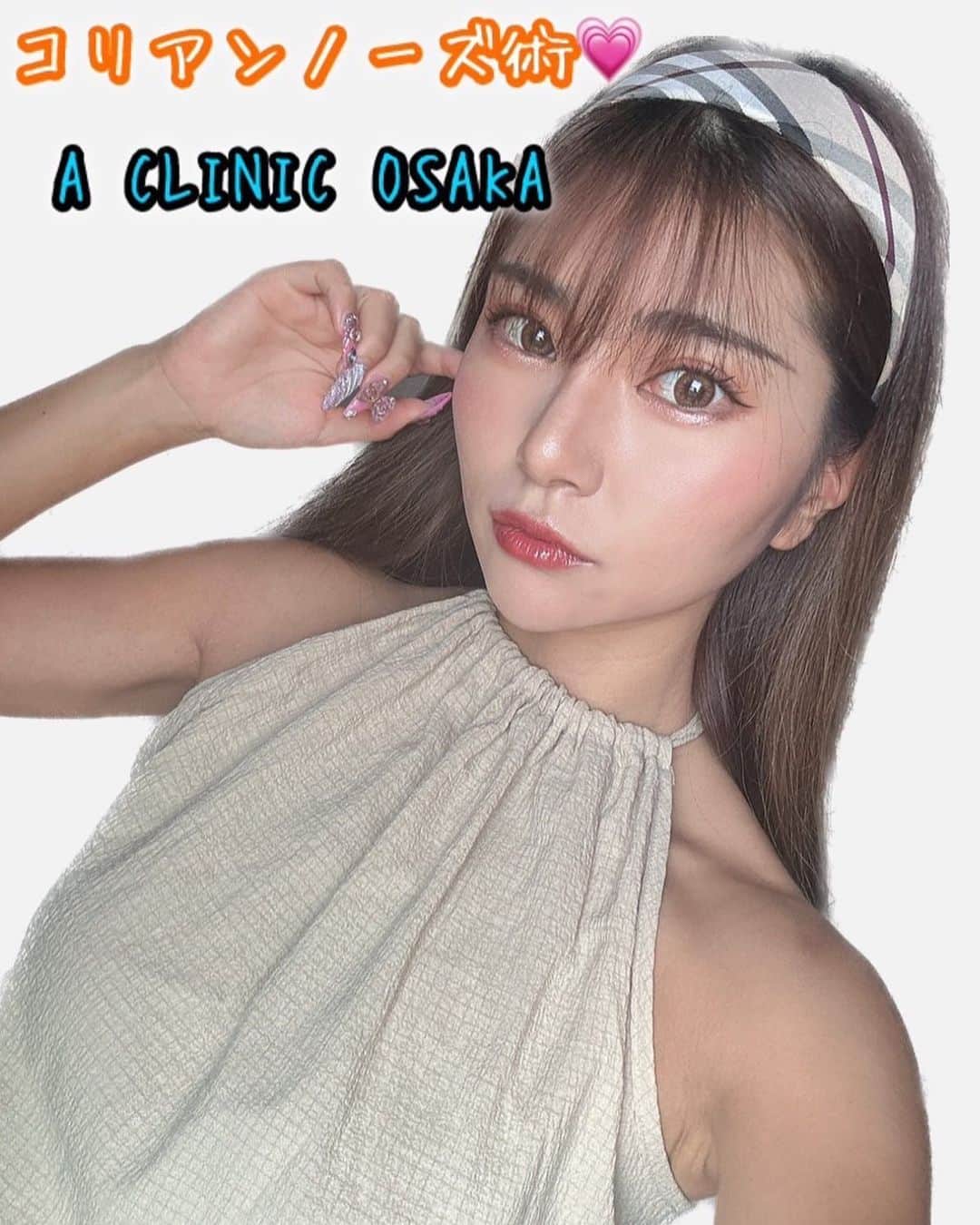 YOCHIのインスタグラム：「@a_clinic_osaka の 田窪先生 @aclinic_takubo  に、《コリアンノーズ術》をしていただき1週間経過しましたっ😊✨  鼻先の丸みが気になっていたのですが ダウンタイムなしで ツンとした鼻先になって大満足です🥰 本当に嬉しいのが、痛みもダウンタイムも 全然なかったこと🥹🥹💖 ノーメイクのときの鼻が コンプレックスでしたが そちらも気にならなくなりました(๑>◡<๑) 周りからも好評で嬉しい🥹💗 メイク感覚でできる施術なので 団子鼻や鼻先の丸みが 気になる方にオススメです！  #コリアンノーズ#鼻先革命#aclinic #aclinic銀座 #aclinic横浜 #aclinic新宿 #aclinic名古屋#aclinic大阪#aclinic池袋 #aclinic福岡#aclinic仙台#aクリニック#エークリニック#美容外科#鼻整形#団子鼻#アップノーズ#田窪賢志郎」