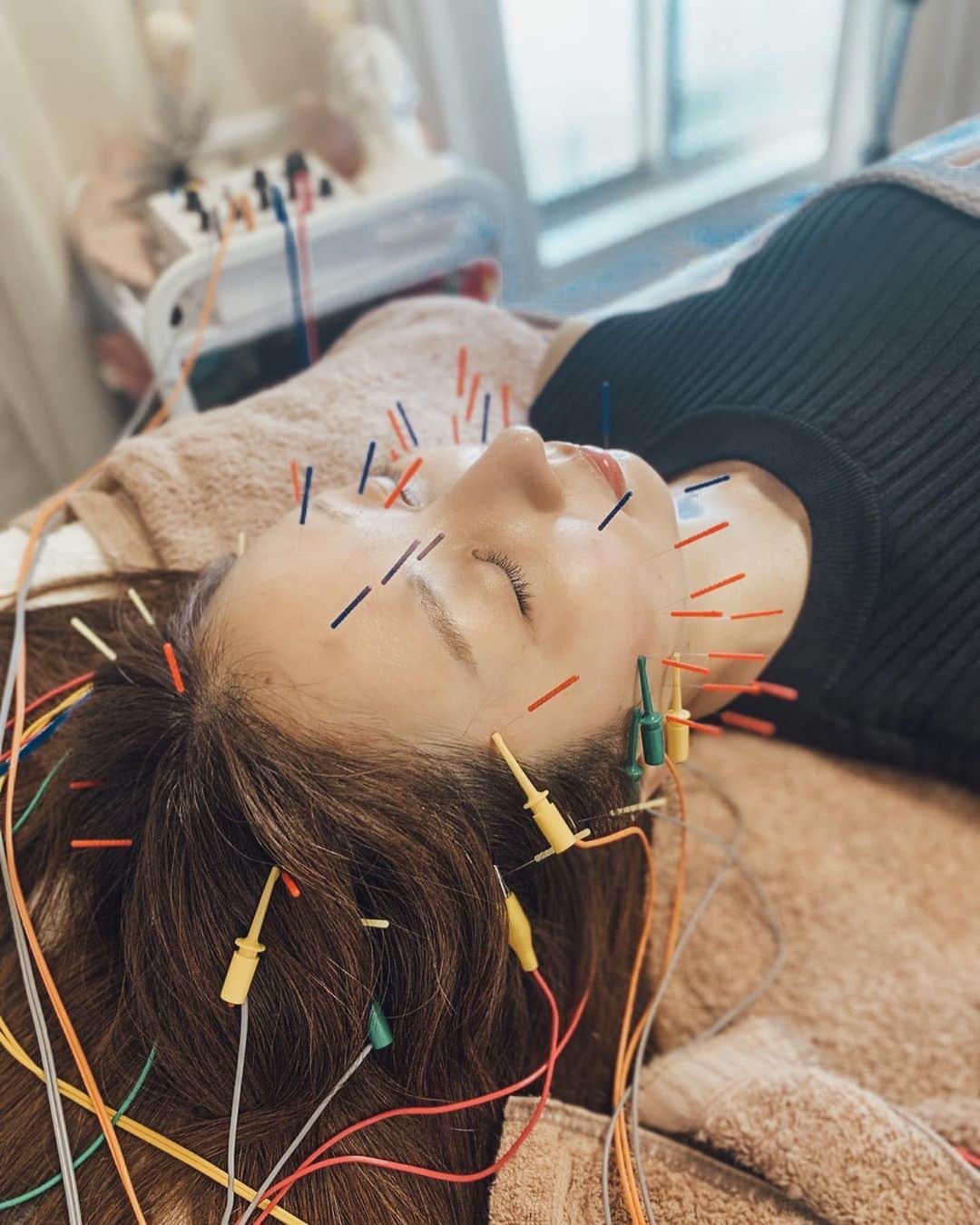 神林真里さんのインスタグラム写真 - (神林真里Instagram)「連休最終日は、 表参道の鍼灸サロンmahoroba で美容鍼やってきました💆‍♀️  ☑︎全顔美容鍼＋頭皮鍼＋陶器肌コース （首肩背中マッサージ＋お顔のハーブピーリング付）  最近は眼精疲労、おでこ&頭皮の凝りが辛かったので しっかり鍼を打っていただき 電気も流していただきました✨  強めの頭皮マッサージはとっても気持ちよくて ハーブピーリングでハリ艶でたよ😌  こちらはプライベートサロンで、 落ち着く空間で丁寧に悩みを聞いていただけたので 久々の鍼だったけど安心して受けられました🫶  初回美容鍼＋陶器肌コース15,800円 で受けられるので、 美容鍼試してみたい方行ってみてくださいね✨  わたしの紹介でご来店、 ご来店いただいた方＋Googleの口コミを書いていただける方は オプションの頭皮鍼(2,750円）を半額付けられるので、 伝えてくださいね！  #鍼灸サロンmahoroba #Supported #美容鍼 #ハーブピーリング表参道 #表参道美容鍼 #小顔表参道 #リフトアップ表参道 #眼精疲労 #東京小顔 #肩凝り#首凝り #身体のメンテナンス #表参道 #連休 #maripo_beauty #relaxtime #weekendmood #acupuncture #beautysalon #facelift #headmassage」7月17日 21時52分 - maripo_jp