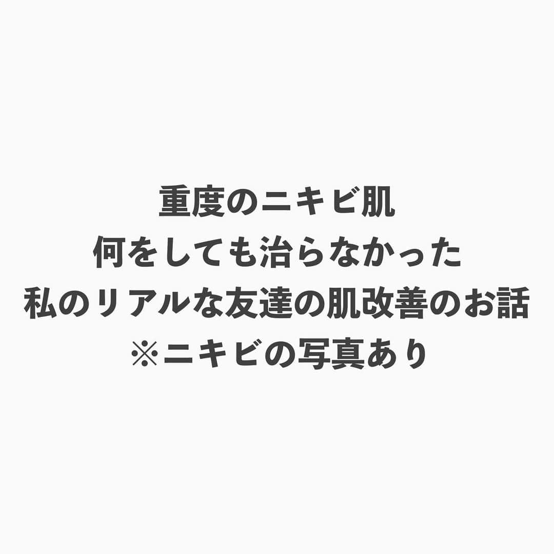 Arisaさんのインスタグラム写真 - (ArisaInstagram)「【私の友達のリアルな肌日記📔※ニキビ肌写真あり】  初めて会ったのはコロナ前。 彼女は全然肌荒れもしてなく綺麗な肌だったんだけど、この間久しぶりに会ったら痛そうなニキビを沢山抱えてて🥲 どーにかこーにかスキンケア会社をやってる私がしてあげたくて、 食生活とか色々アドバイスをしたんだけど、良くならなくてね、、、 本人が1番気をつけてるの分かってるから、それなのに肌が良くならなくてストレスだろうなぁと思ってたんだよね😩  そんなある日彼女が私のストーリーみて、私買う！VITADROP使ってみる！って飛び込んでくれて😢😢😢💛  それからのストーリーがこの画像なんです🥹🙏  前にトゥルースドロップもまつ毛美容液もと色々試してくれていたんだけど、続ける事が難しくまた絶対使いたい！！って言ってくれてたトゥルースドロップもまた再開してくれてて🥲  私は何より彼女の心を救えたのがほんっとうに嬉しくてね🥲 身近なお友達をこうして助けられるのって本当素敵な事だなぁと思いました🥲🥲🥲きっとね、私の友達で私に報告してなく使ってくれてる子沢山居るんだよね。 本当嬉しい🥲  顧客様のピースラバーの皆様の中でもきっとこうして手助け出来てる人が少なからずとも居るんだと思うと、本当このお仕事をしていて良かったと心から思えます😢💛  この場を借りて本当にありがとうございます。 そして試してくれたけど、肌に合わずむしろ荒れてしまったという方も勿論いらっしゃると思います。 その方達には本当謝罪する事しか出来ず申し訳ございませんが、本当に悔しくてならないです🙇‍♀️ 一歩を踏み出して下さりありがとうございます😭  この投稿もまた誰かの励みや力になると信じて本人に了承を得て投稿させて頂きました。  TJC→トゥルースジュレクレンズ（クレンジング） TSW→トゥルースシルクウォッシュ（洗顔） VD→ビタドロップ（ビタミンC美容液） TD→トゥルースドロップ（保湿美容液） FRP→エフリムーバルパック（水素パック）  @peaceofshine   #美肌への道のり」8月13日 10時55分 - saarariii