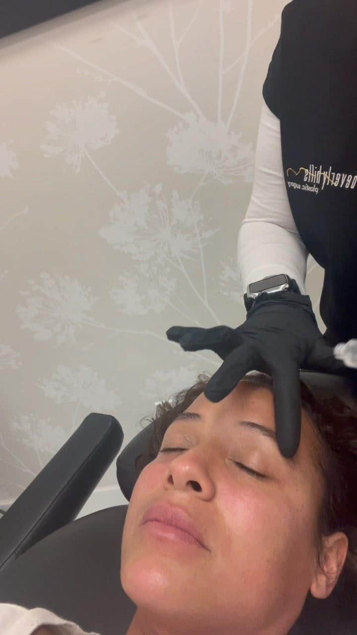 ダニア・ラミレスのインスタグラム：「This was my final @sylfirmx.usa treatment with @benevexosomes LOVING IT!!! #skinrenewal the “sorta” natural way 😜💕 Me encantó el tratamiento.  Este fue el último! 🙏🏽 @drchiubhps no one does it better! #nofilterneeded」