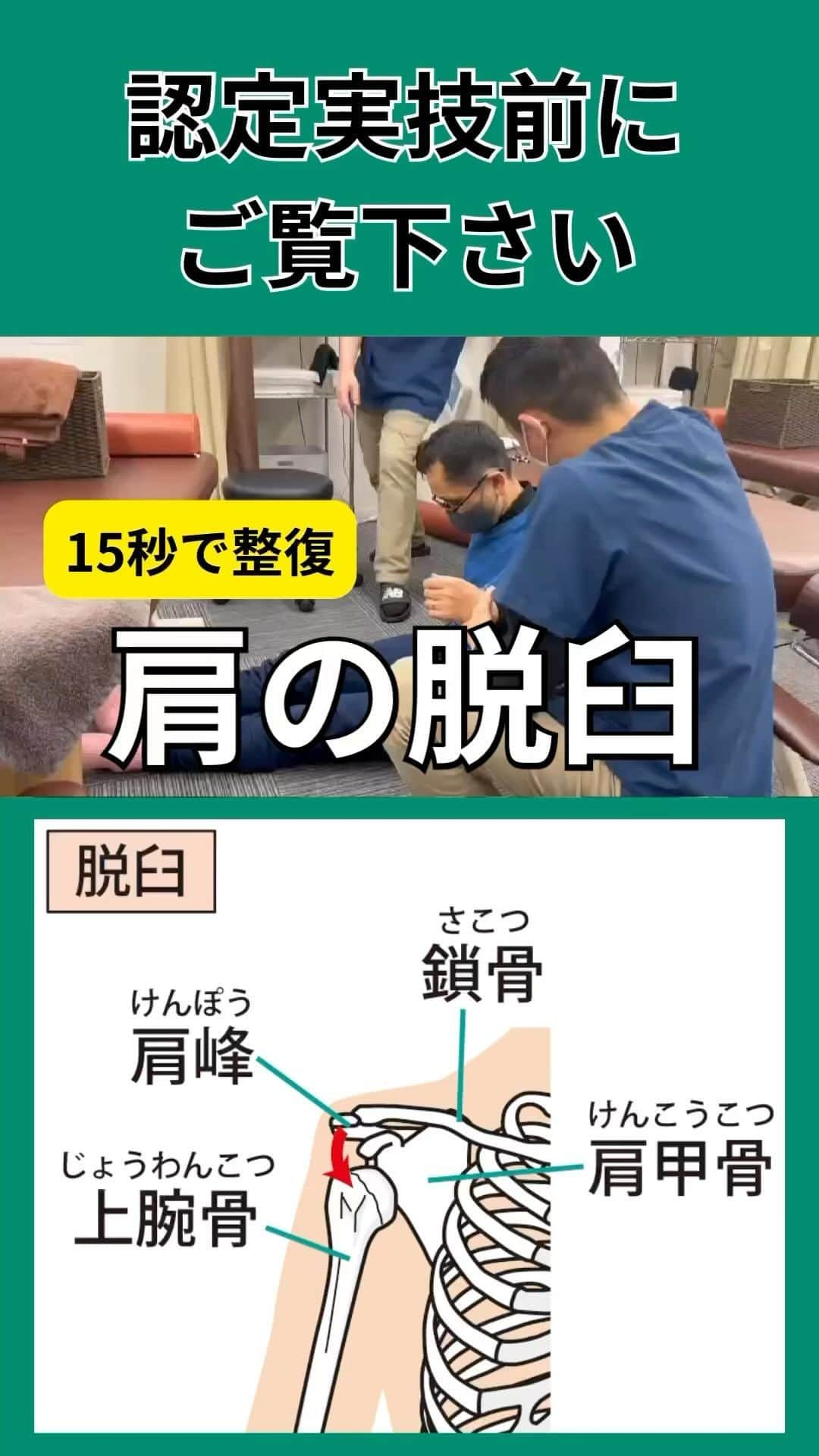 大阪の整体師 庄本のインスタグラム：「認定実技前に、 実際どのように整復しているのかご覧下さい👍  当院は自費の治療院なので、慢性の症状を診ることが大半です。  そのため、院内は急性症状を診るに環境は充分ではありませんが施術者は今ある環境でベストを尽くさなければいけません🙌  #柔道整復師学科 #柔道整復師専門学校 #柔整 #柔整師 #柔整学生 #柔整科 #柔道整復師と繋がりたい  #柔道整復師求人 #柔道整復師募集 #柔整学科 #鍼灸師 #鍼灸師の卵 #鍼灸学生 #鍼灸マッサージ師 #鍼灸師募集 #鍼灸師と繋がりたい #鍼灸師求人   【ヴァーテックス株式会社】 553-0003 大阪市福島区福島5-13-18福島ビル203 代表取締役　庄本泰崇  2024年入社スタッフ募集＊定員3名 月給280000円（試用期間3ヶ月200000円）  ・柔道整復師 ・鍼灸師  まずは会社見学からどうぞ！  院アカウント @vertex.chiryoi ngp」