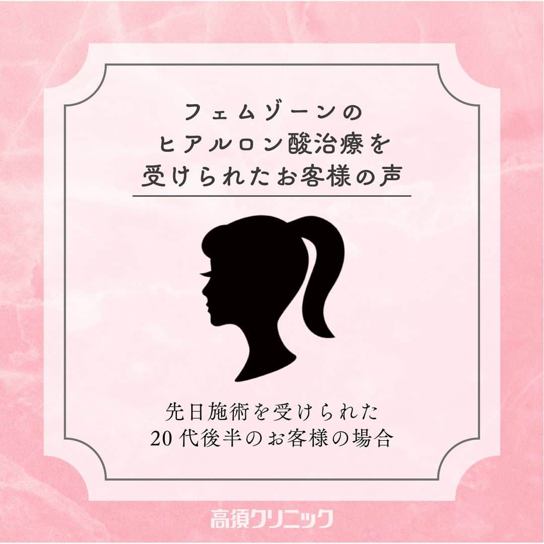 高須クリニック名古屋院のインスタグラム：「女性のお悩みに👒🍀 膣ヒアルロン酸注射とは、膣をふっくらさせてゆるみを改善する治療です💉✨ 出産後や加齢とともに気になってくる、膣の変化。パートナーにゆるいと指摘されたり、自分でも快感が得にくいと感じていたり。あなただけではなく、実は多くの女性が悩んでいます。誰にも打ち明けられない膣トラブルを、注射という気軽さで解決してくれるのが『膣ヒアルロン酸注射』です😊  今回は実際に膣ヒアルロン酸治療を施術された20代女性の方のリアルな感想をご紹介させていただきます🤍  今回紹介した施術以外にも、 高須クリニックでは、なかなか人には言えないデリケートな悩みもクリアする、多くの技術を網羅✨ 入念なカウンセリングを行った上で、一人ひとりに合わせた最適な施術を行います。  真摯な姿勢で対応しますので、ひとりで思い悩まずにぜひ相談してください❣️  【施術料金】 ●膣ヒアルロン酸注射 ・ライト ￥165,000（税込） ・スタンダード ￥275,000（税込） ・グラマラス ￥330,000（税込） 【銀座高須クリニック、横浜、名古屋、栄】  ・Gスポットヒアルロン酸注射 1回 ￥165,000（税込） 【銀座高須クリニック、横浜、名古屋、栄】  ・大陰唇ヒアルロン酸注射 1回 ￥220,000（税込）～￥440,000（税込）  【銀座高須クリニック、横浜、名古屋、栄】  ※局所麻酔（麻酔外用）＋笑気麻酔無料  【リスク・副作用・合併症について】 ●膣ヒアルロン酸注射／Gスポットヒアルロン酸注射 ・腫れが生じる可能性 ・内出血する可能性  ------------------------------------------------------- 📍 【ご予約・お問い合わせ】 ☎️052-564-1187 📩nagoya@takasu.co.jp 📱@takasuclinic_nagoya ↑インスタのプロフィール画面からからも直接コンタクトがとれます📲 . 【名古屋院ドクターのアカウント🩺】 幹弥先生📱@takasumikiya 英津子先生📱@etsuko_takasu 森本先生📱@takasuclinic_dr.morimoto 笠井先生📱@takasu_dr.Kasai ゆかり先生📱@yukarinrinchan 吉武先生📱@dr_yoshitake  #高須クリニック名古屋院 #高須クリニック #高須英津子 #藤田ゆかり#高須幹弥 #美容整形 #デリケート #デリケートゾーン #産後 #出産後#膣 #緩み#膣のゆるみ #膣の引き締め #パートナー #ケア #ヒアルロン酸」