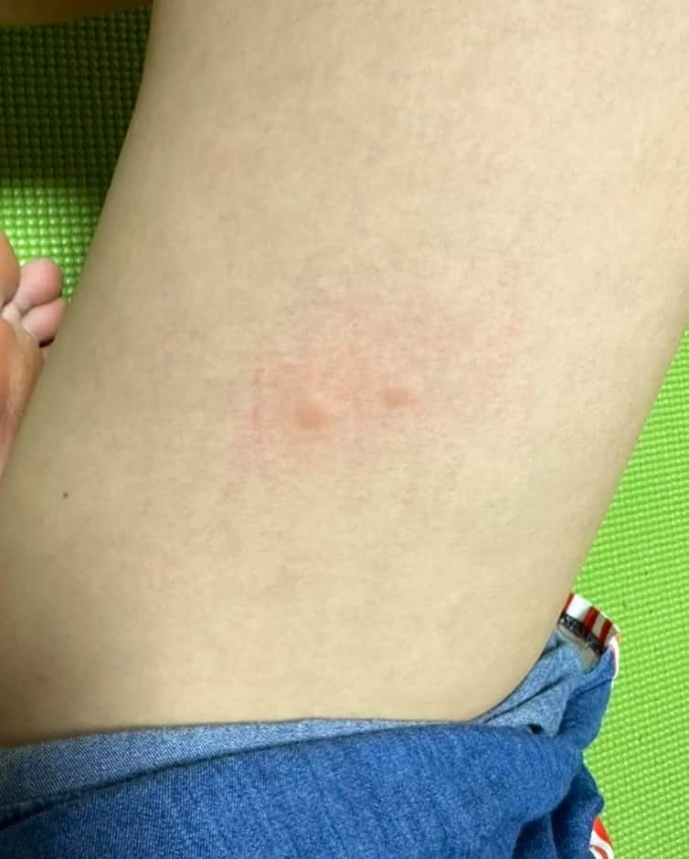 のインスタグラム：「朝活！  日曜日の朝は特別早い！  ストレッチで 目さまそう！！  夏の洗礼を早速受けてます🦟  #朝活 #ストレッチ」
